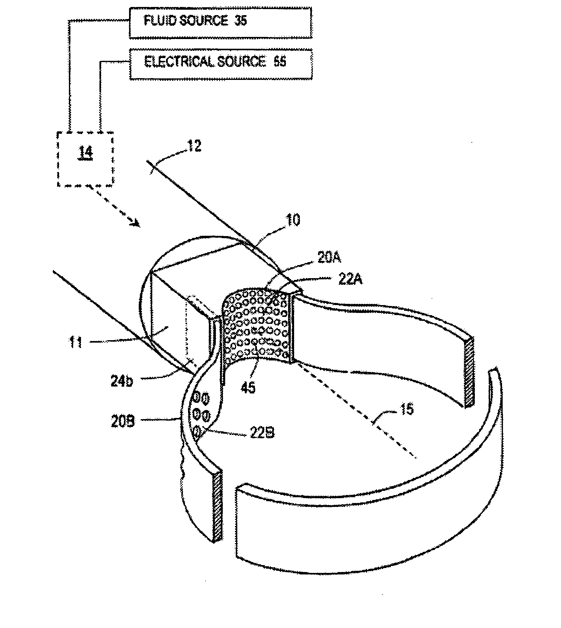 Medical instrument and method of use