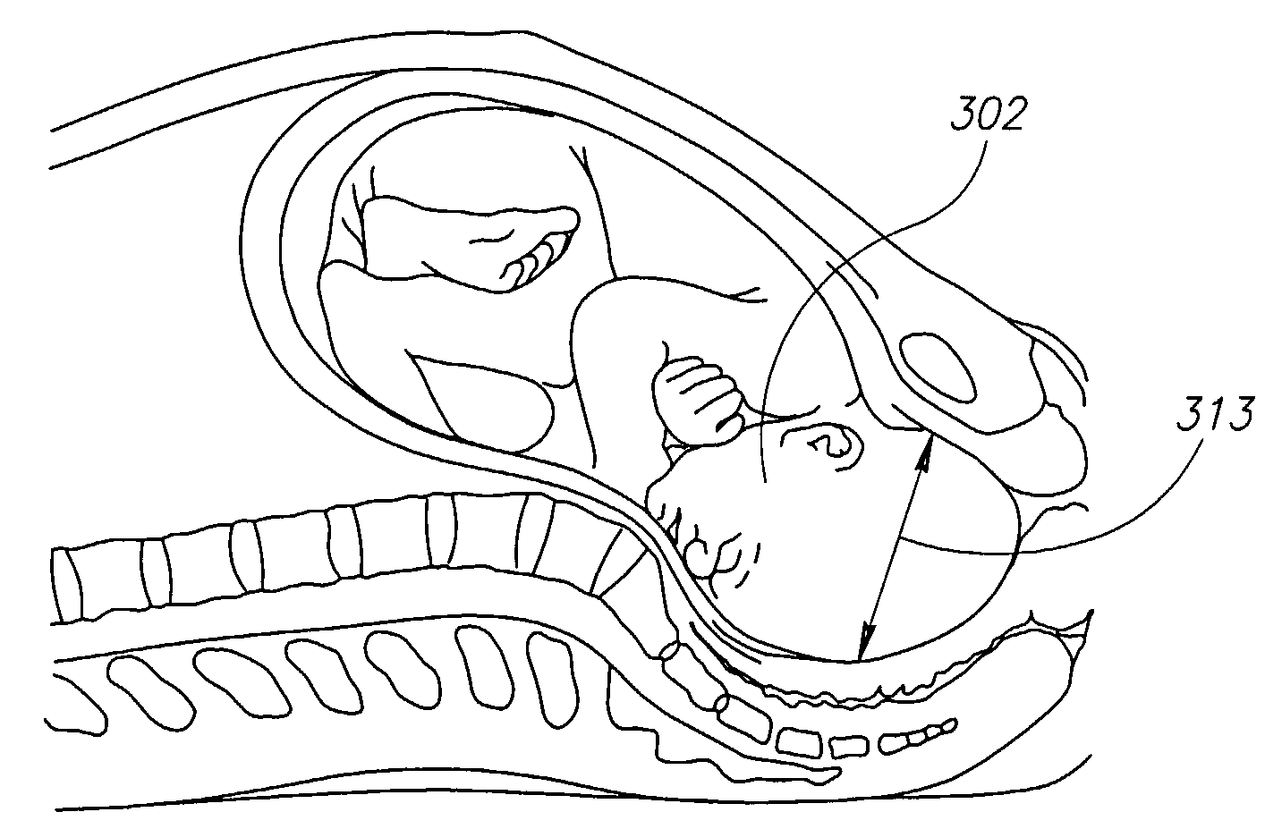 State Based Birth Monitoring System