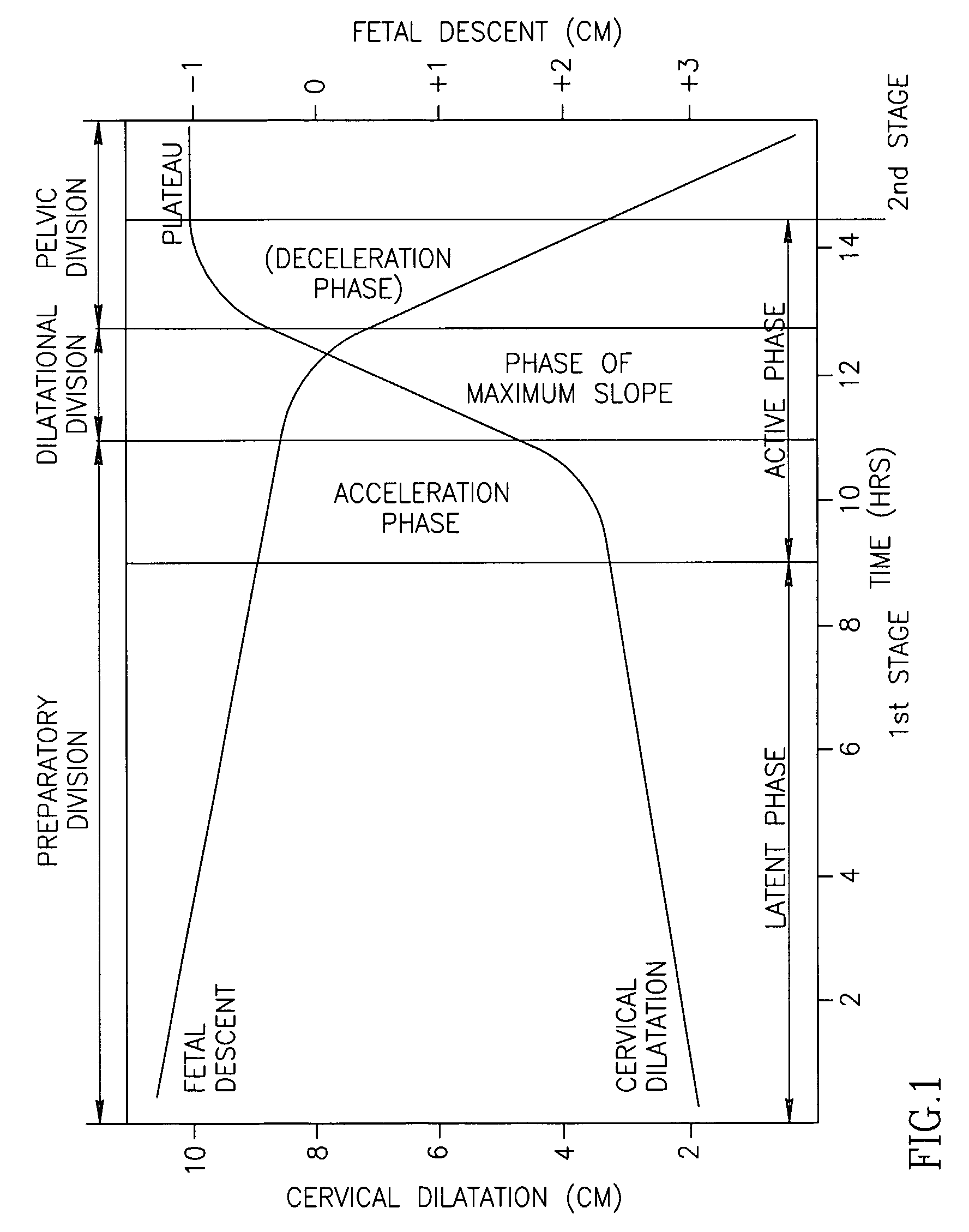 State Based Birth Monitoring System