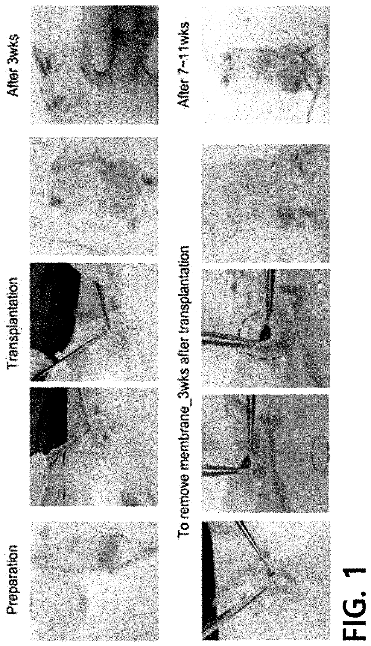 Method for culturing 3-dimensional lung cancer organoid and method for preparing patient-derived xenograft animal model using same