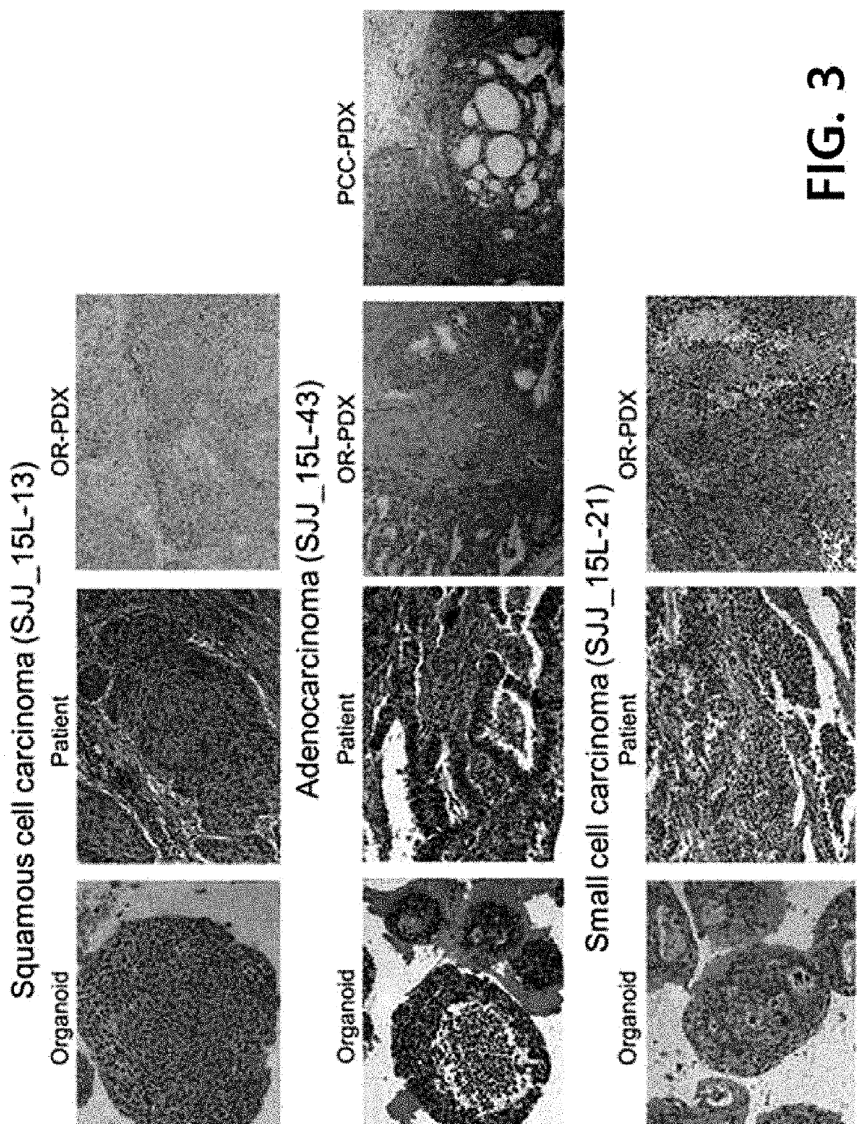 Method for culturing 3-dimensional lung cancer organoid and method for preparing patient-derived xenograft animal model using same