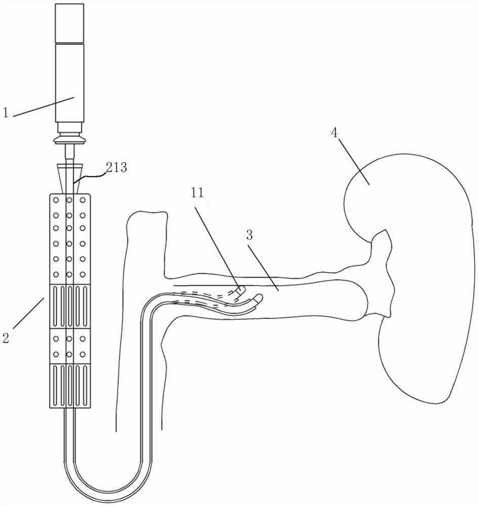 a guiding catheter