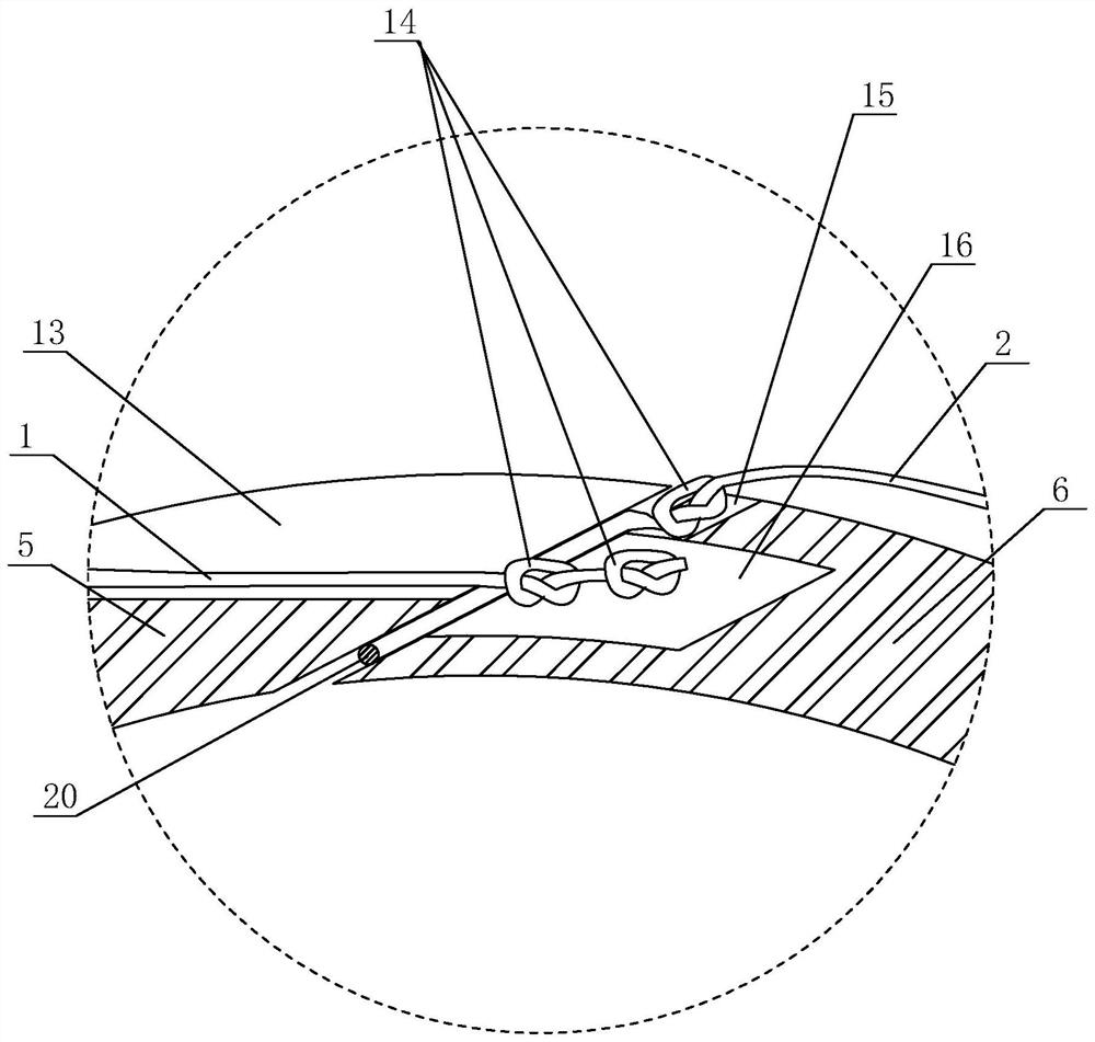 Annulus fibrosus suturing device and its suturing method after intervertebral disc herniation