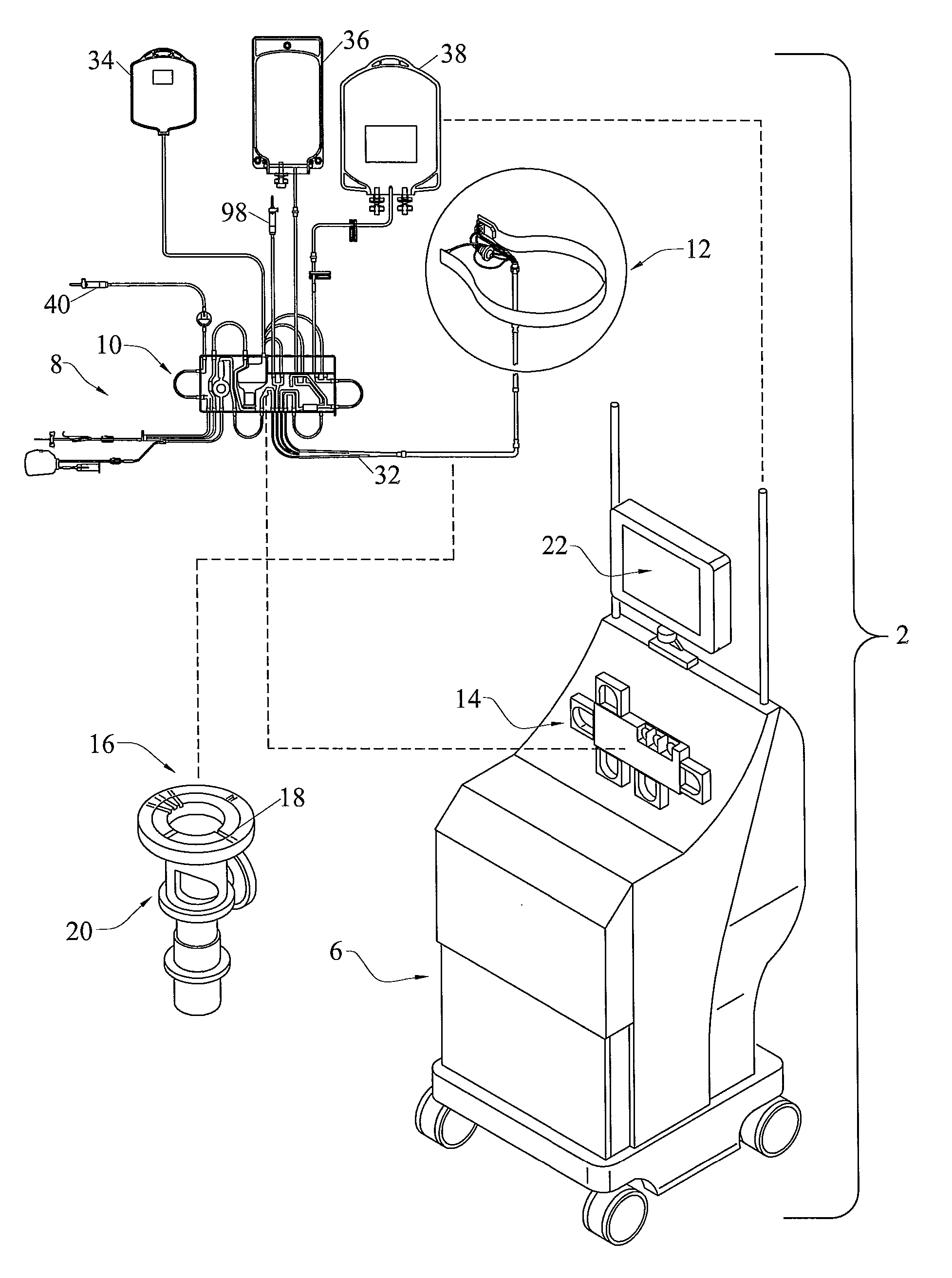 System for Blood Separation with Gravity Valve for Controlling a Side-Tapped Separation Chamber