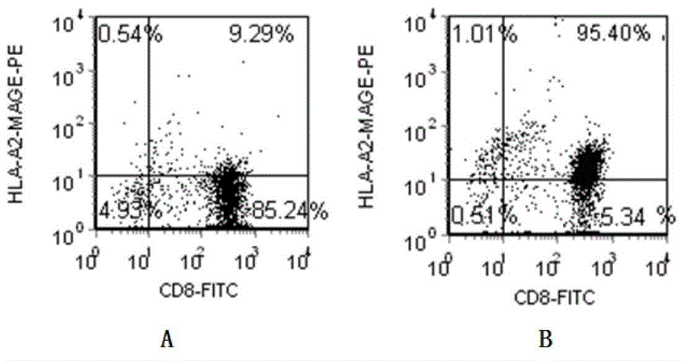 Preparation method of HLA-A0201 (Human Leukocyte Antigen-A0201) restrictive anti-MAGE (MicroArray and Gene Expression) antigenic specificity CTL (Cytotoxic T Lymphocyte)