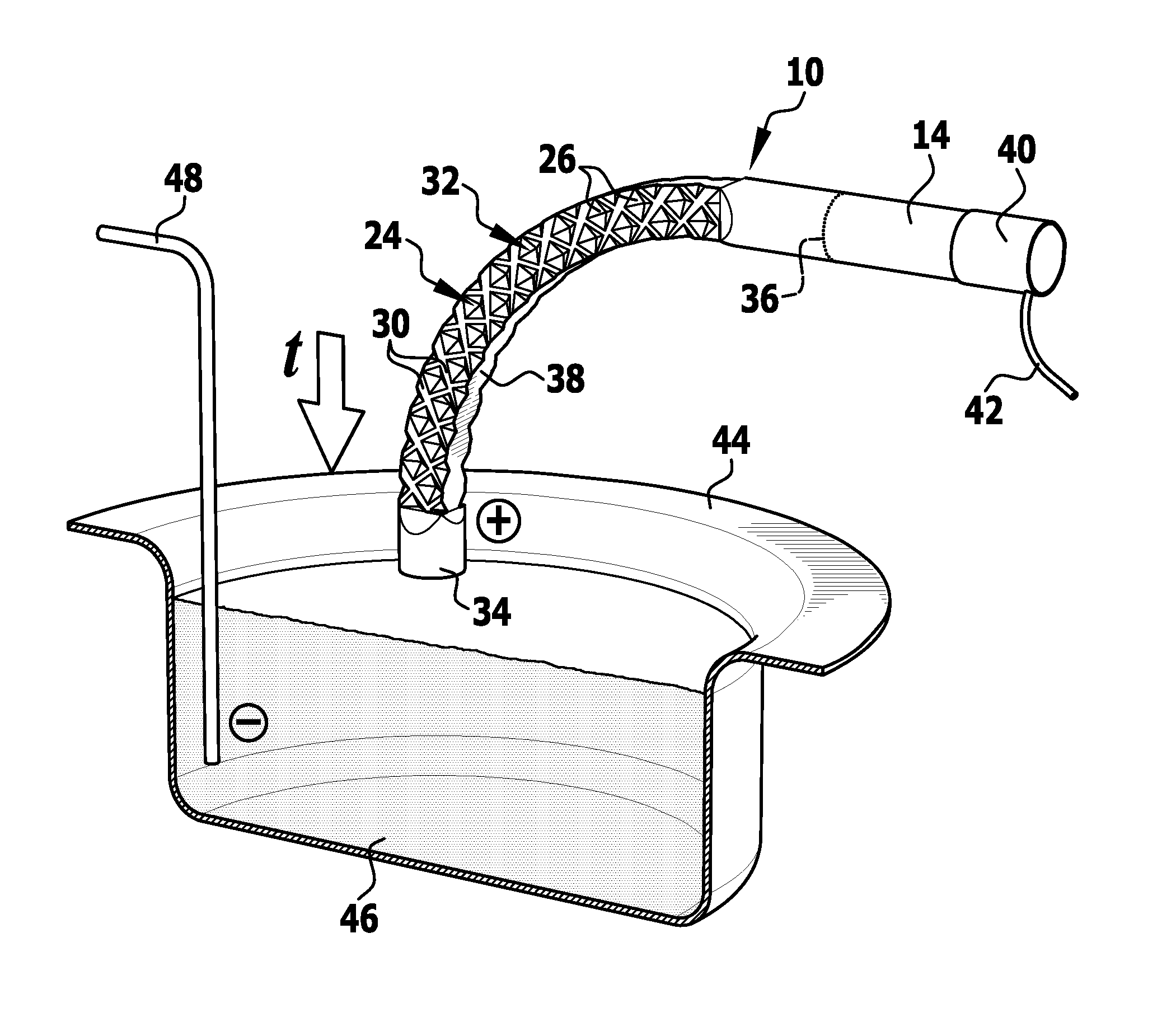 Surgical needle and method of manufacturing a surgical needle