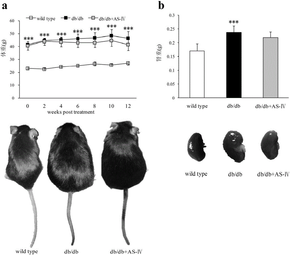 Application of astragaloside in preventing and treating type 2 diabetic nephropathy