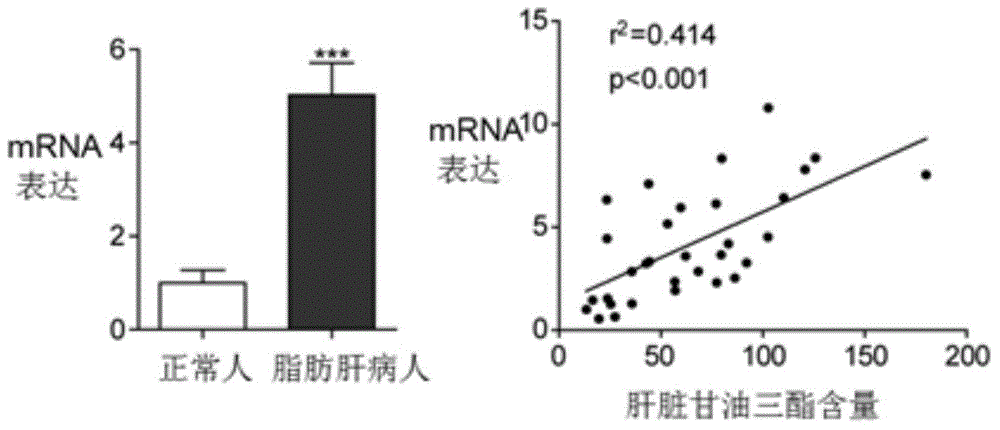 Antibody to periostin and its application in drug preparation