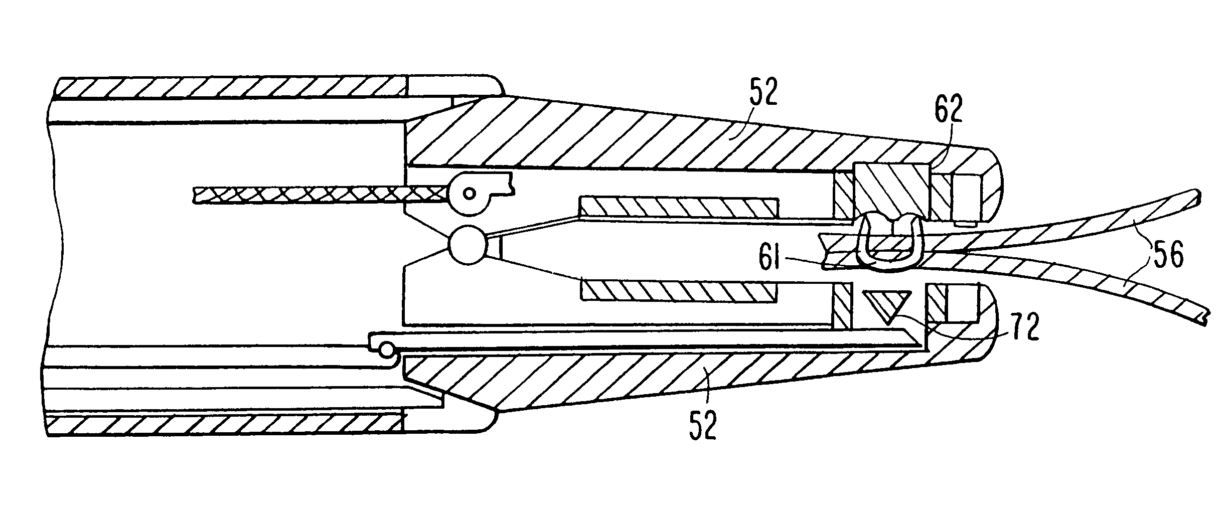 Method and apparatus for circulatory valve repair