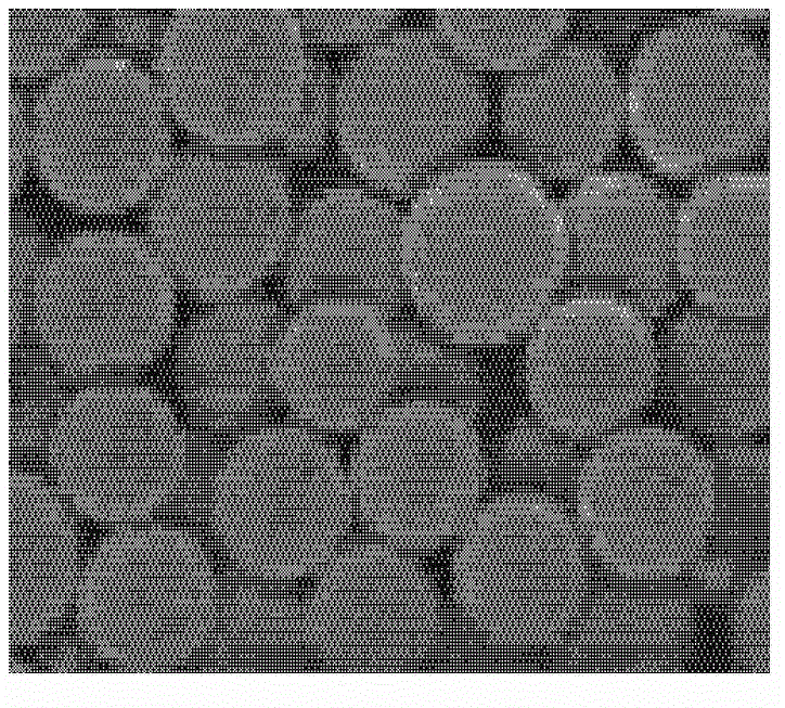 Teriparatide sustained-release microsphere and preparation method thereof