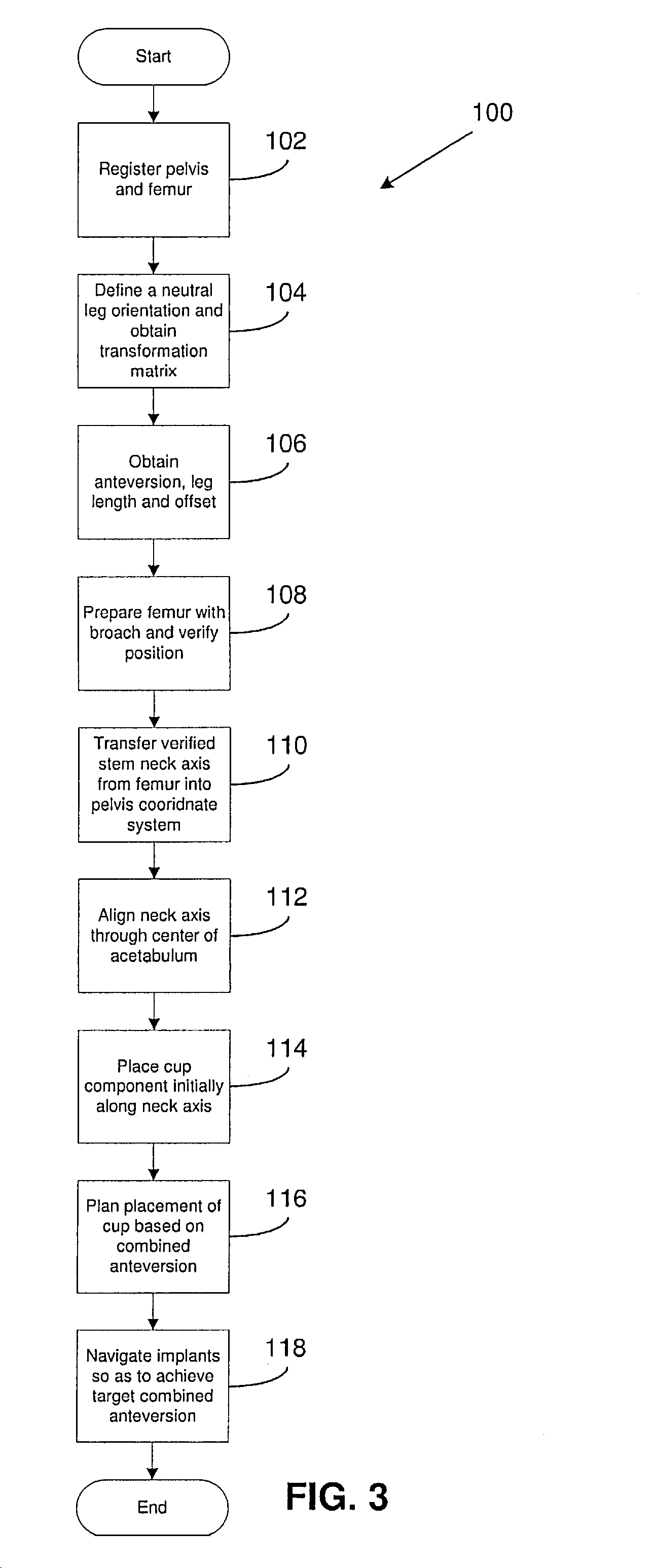 Navigated placement of pelvic implant based on combined anteversion by applying Ranawat's sign or via arithmetic formula