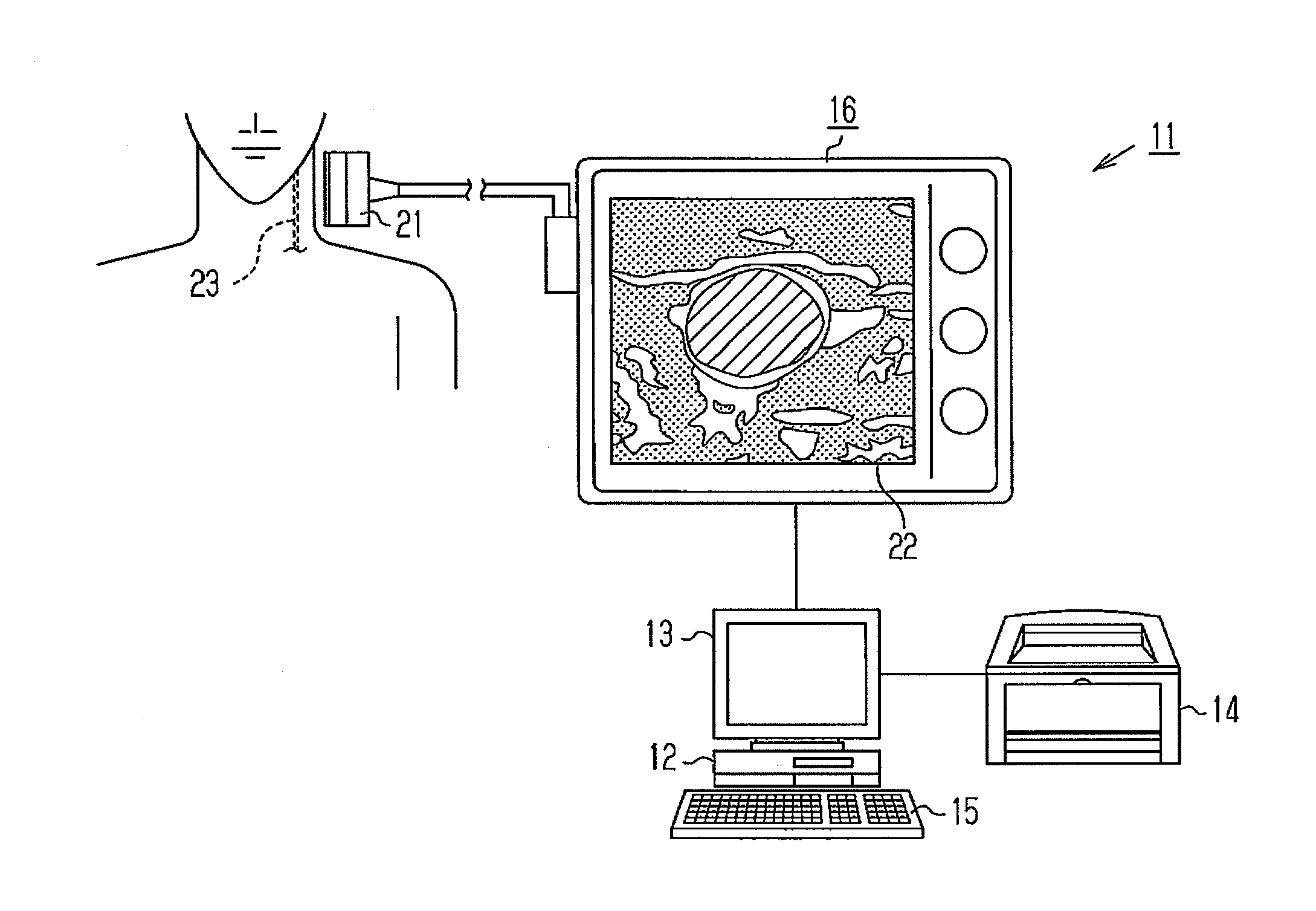 Image processing apparatus, image processing program, storage medium and ultra-sonograph