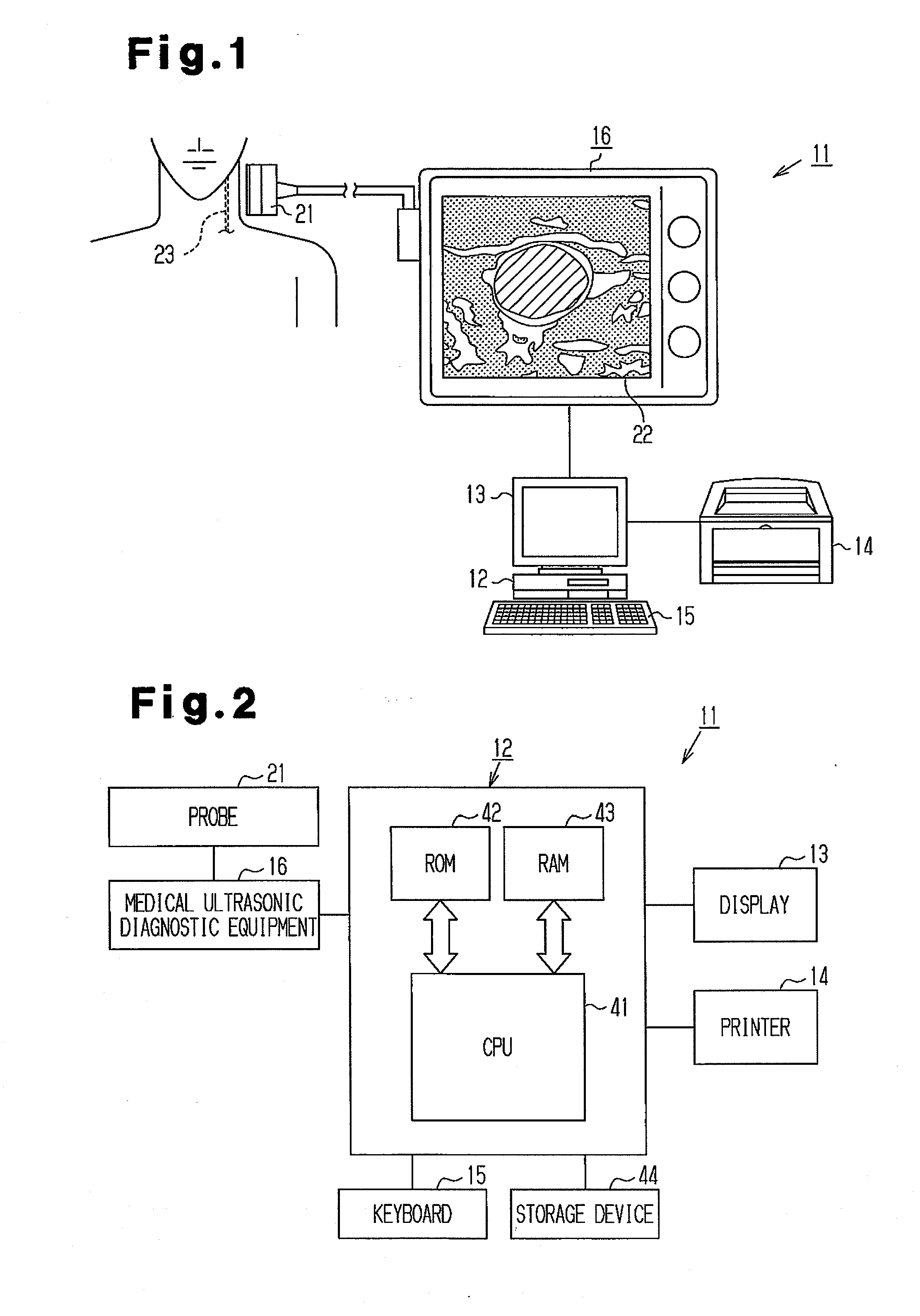 Image processing apparatus, image processing program, storage medium and ultra-sonograph