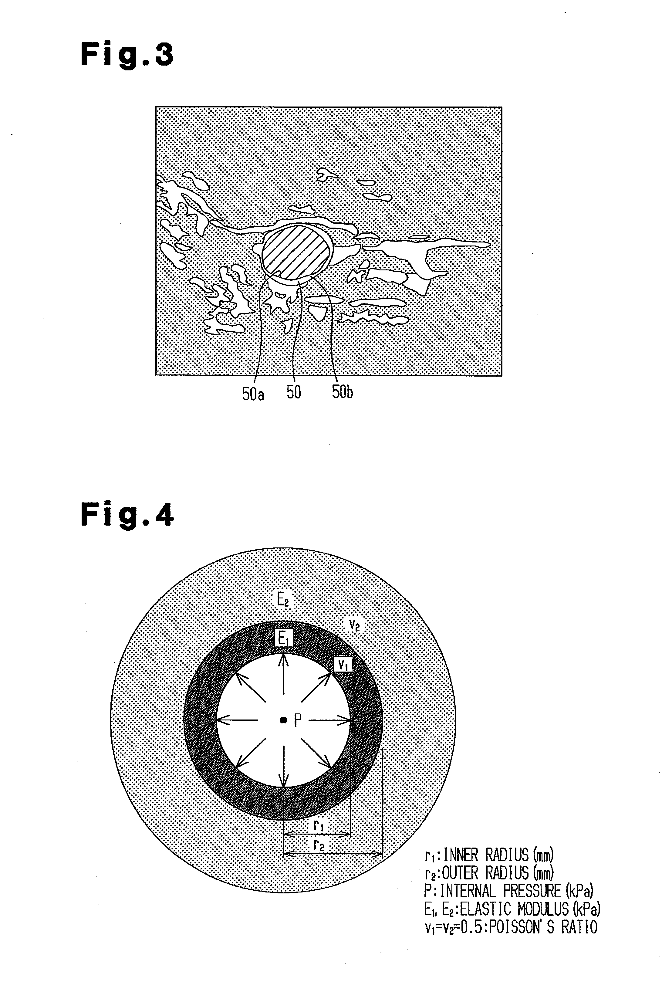 Image processing apparatus, image processing program, storage medium and ultra-sonograph