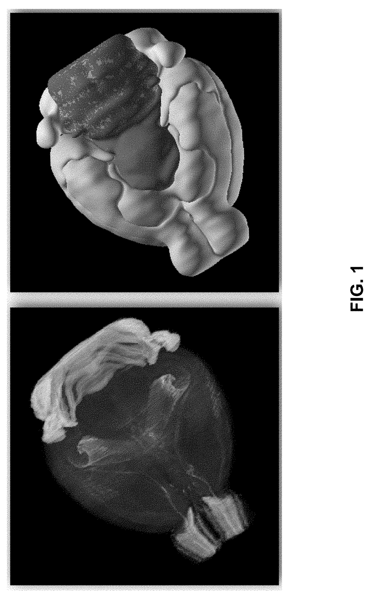 System for interpretation of image patterns in terms of anatomical or curated patterns