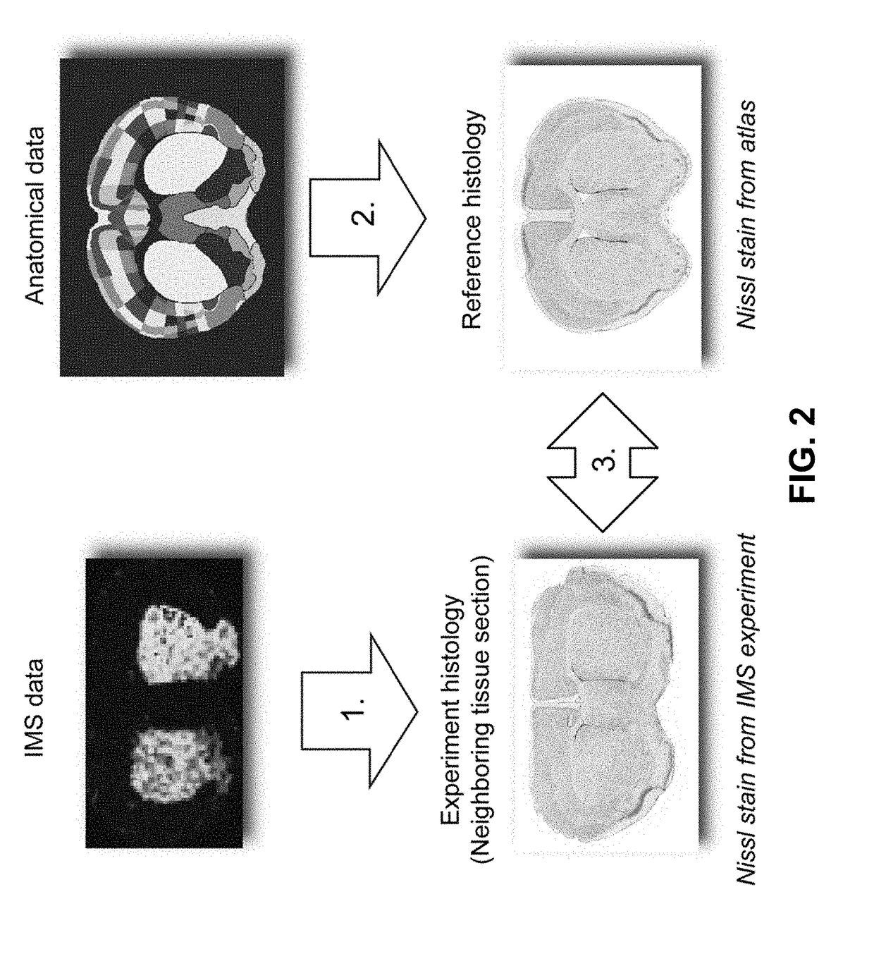 System for interpretation of image patterns in terms of anatomical or curated patterns