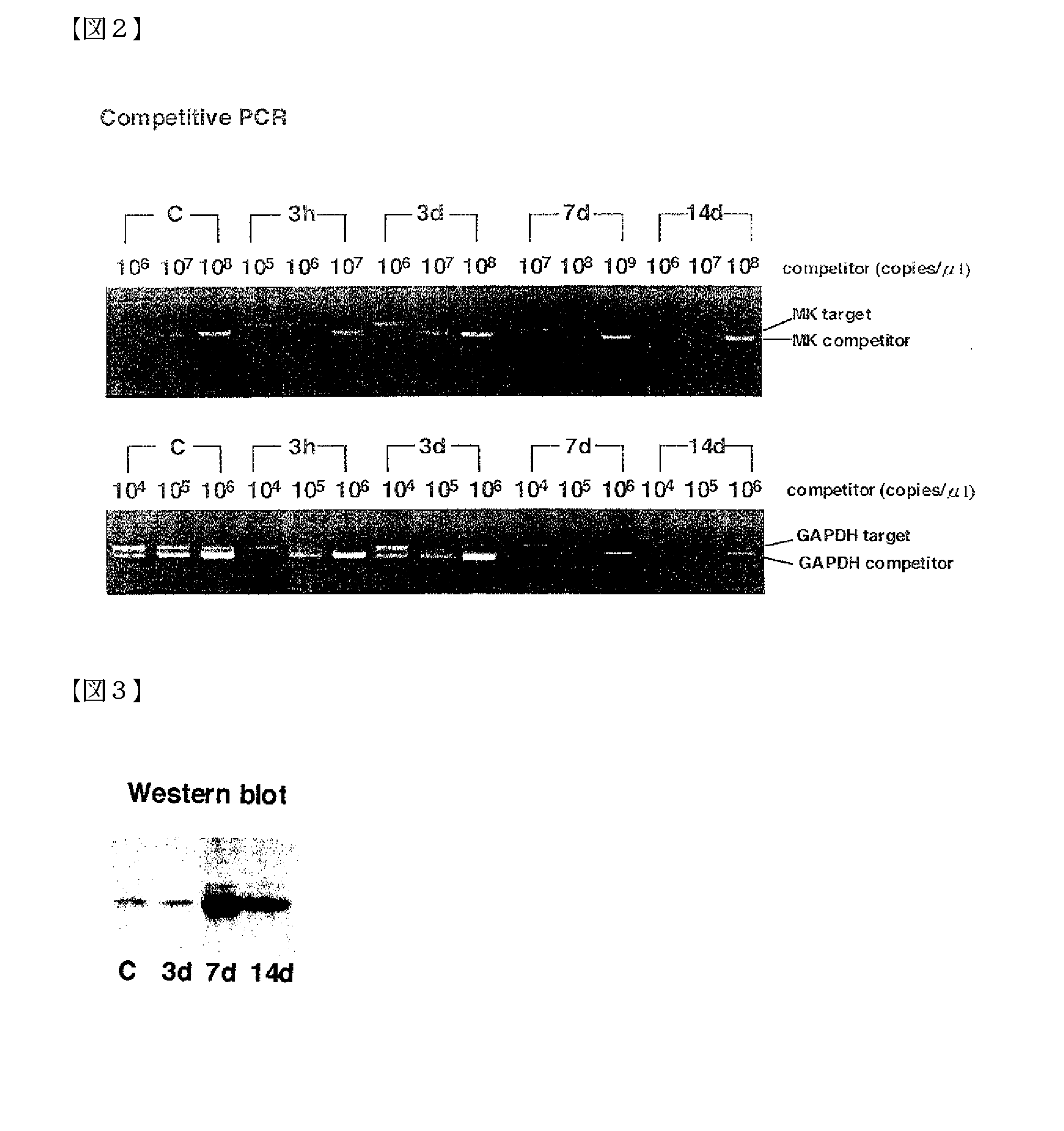 Pharmaceutical Compositions for the Prevention and Treatment of Atherosclerosis and Restenosis After PTCA