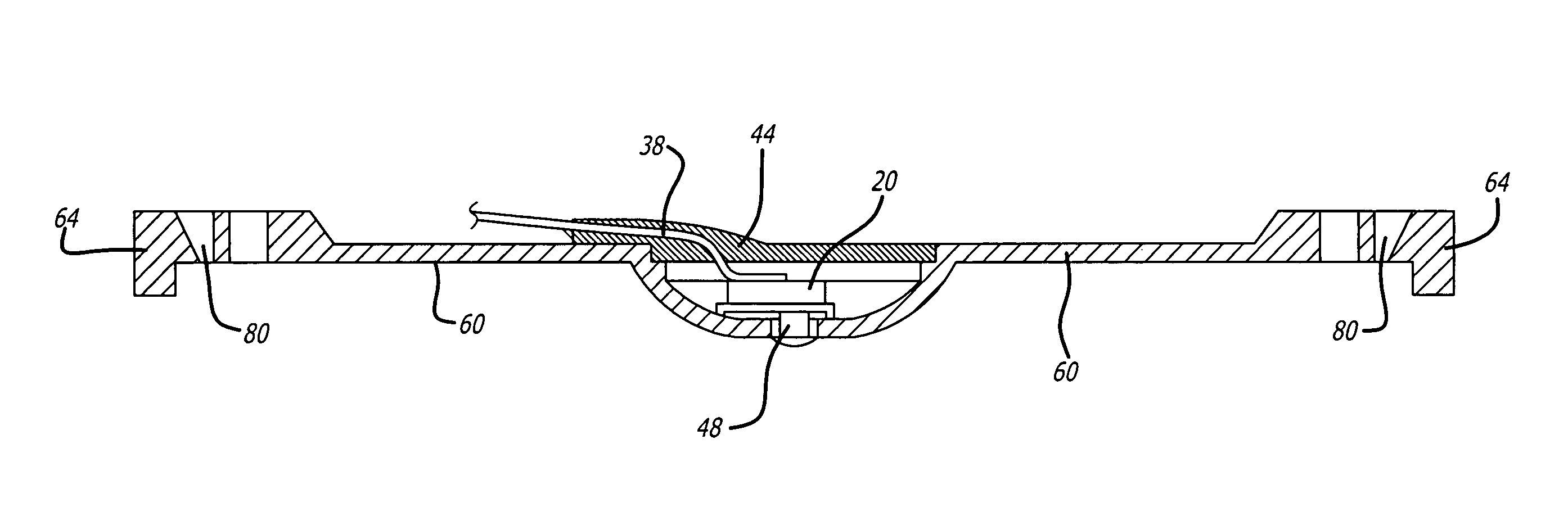 Uterine contraction sensing system and method