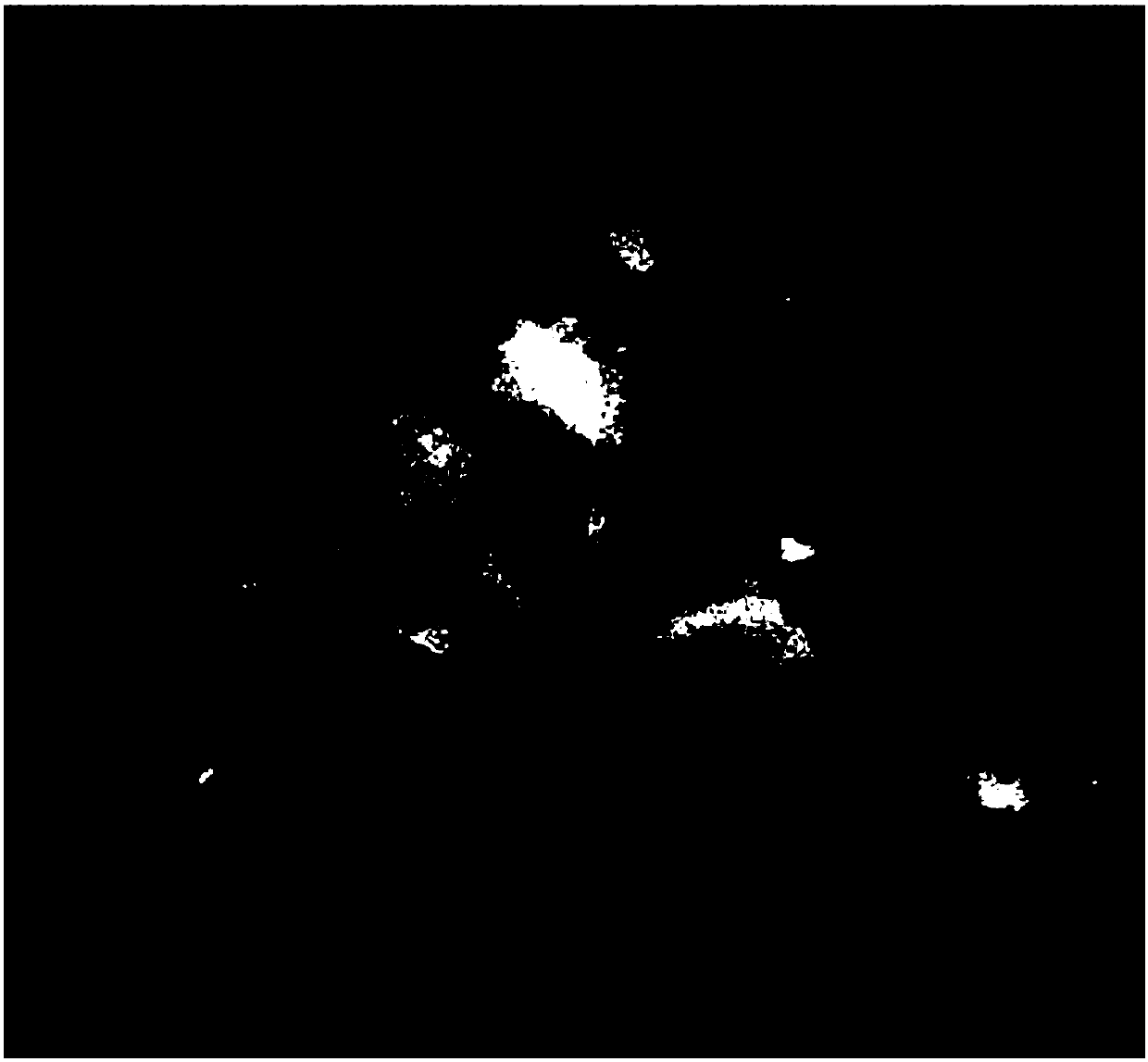 A kind of andrographolide and glycyrrhizin double drug nanocomposite particle and its preparation method and application