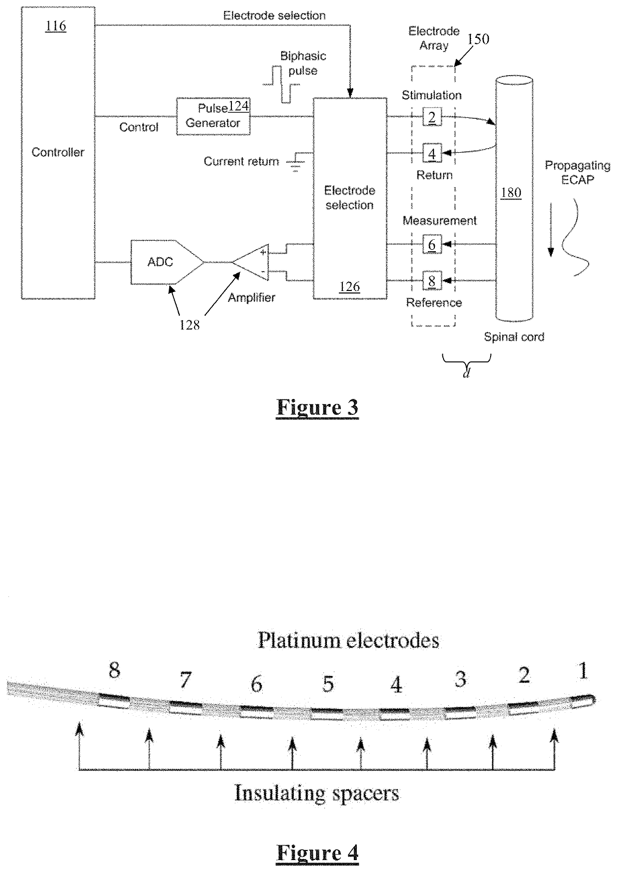 Neurostimulation Artefact Minimisation