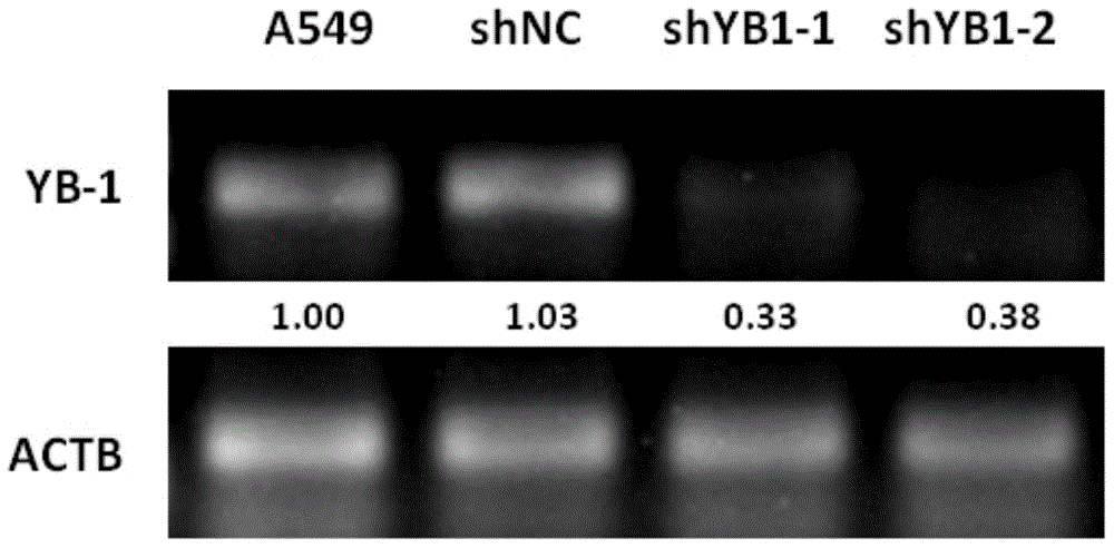 shRNA (short hairpin ribonucleic acid) targeted interfering YB-1 gene human lung adenocarcinoma a549 cell strains capable of stably expressing GFP (green fluorescent protein)