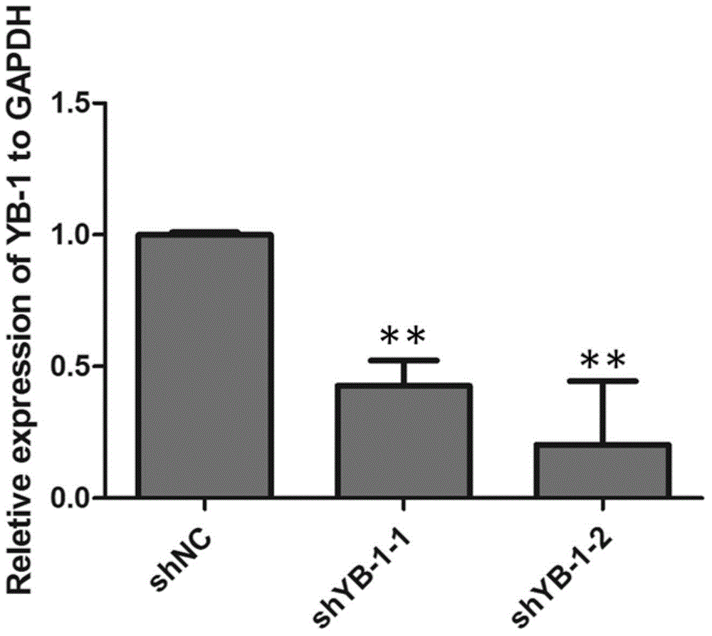 shRNA (short hairpin ribonucleic acid) targeted interfering YB-1 gene human lung adenocarcinoma a549 cell strains capable of stably expressing GFP (green fluorescent protein)