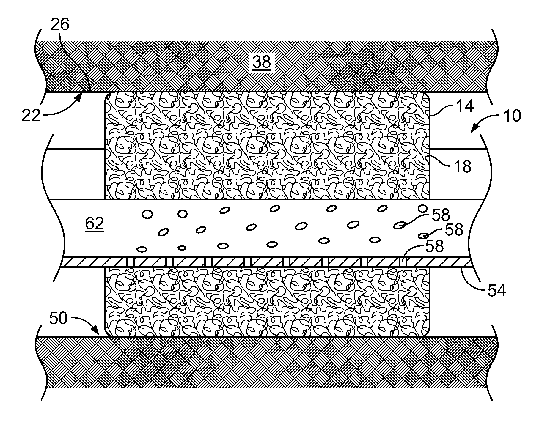 Screen, method of expanding a screen and method of conforming a screen to a borehole