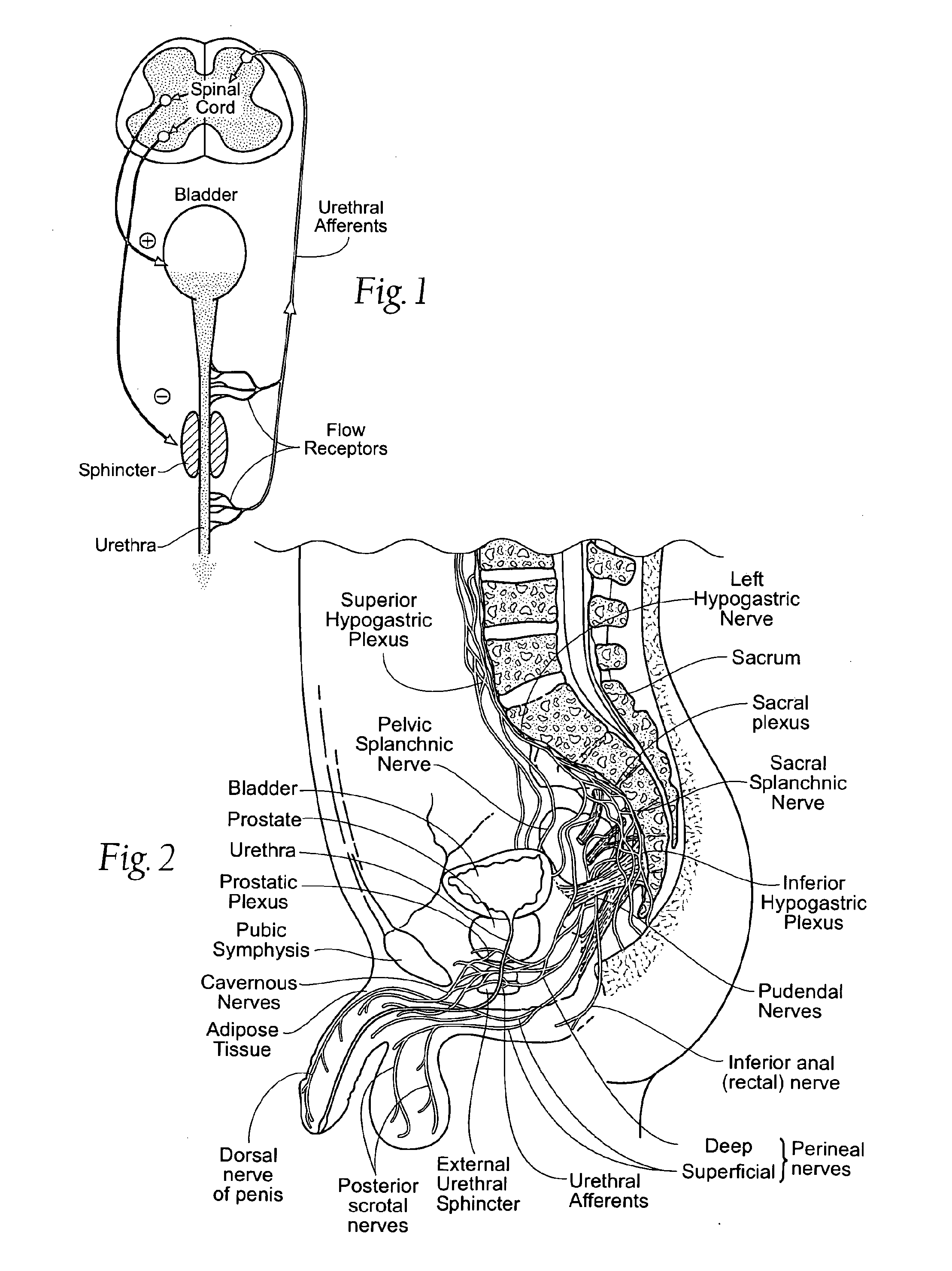 Systems and methods for the treatment of bladder dysfunctions using neuromodulation