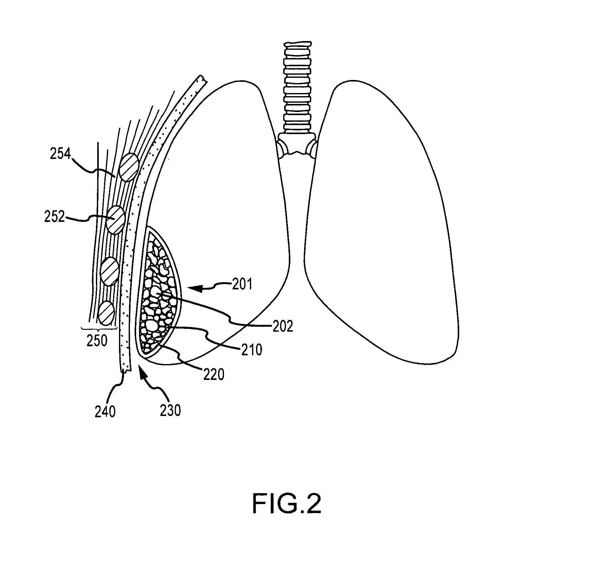 Use of a regenerative biofunctional collagen biomatrix for treating visceral or parietal defects