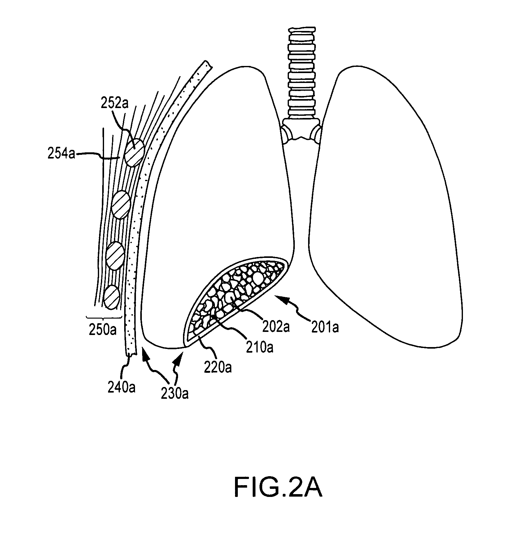 Use of a regenerative biofunctional collagen biomatrix for treating visceral or parietal defects