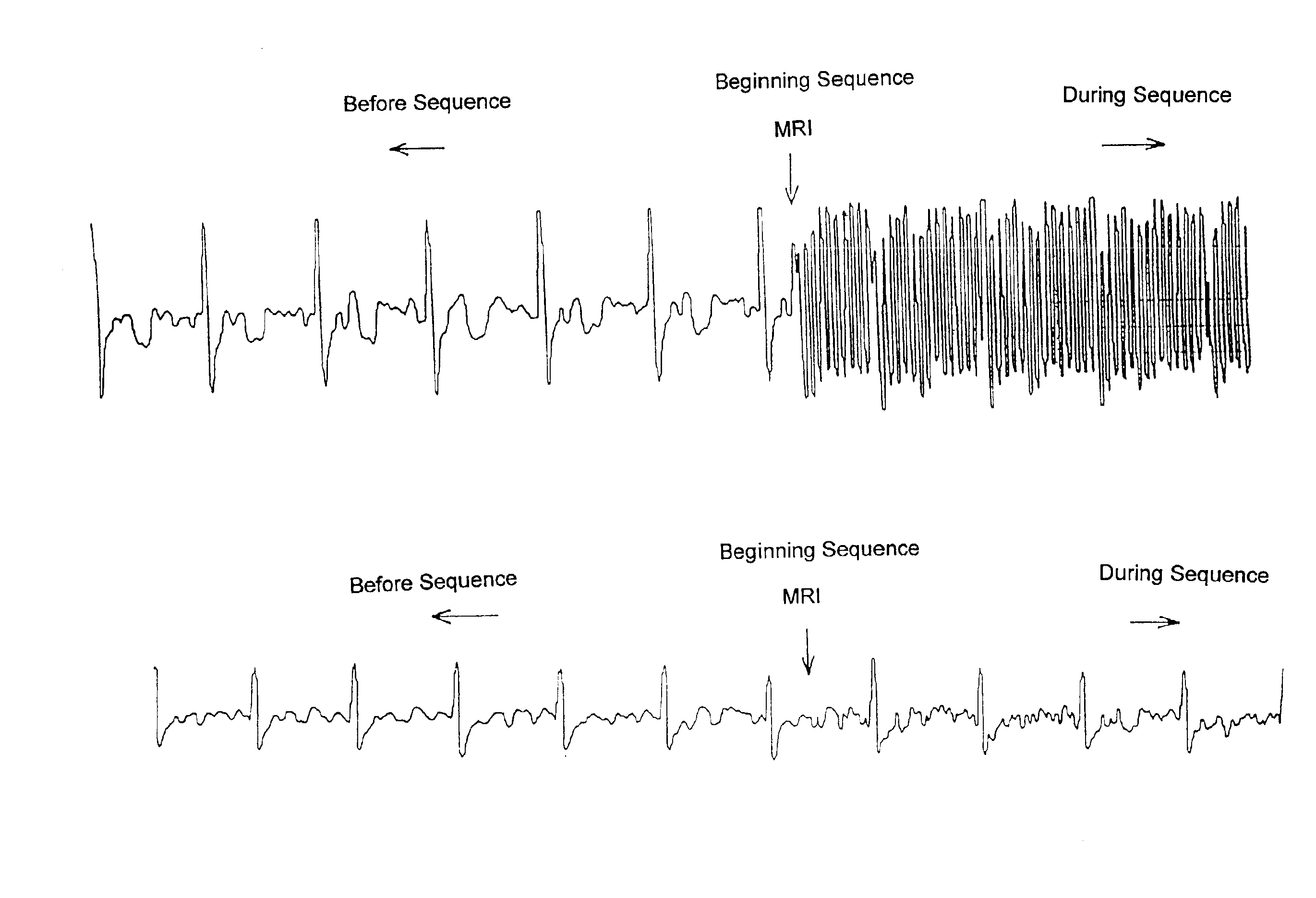 Method and apparatus for obtaining an electrocardiograph