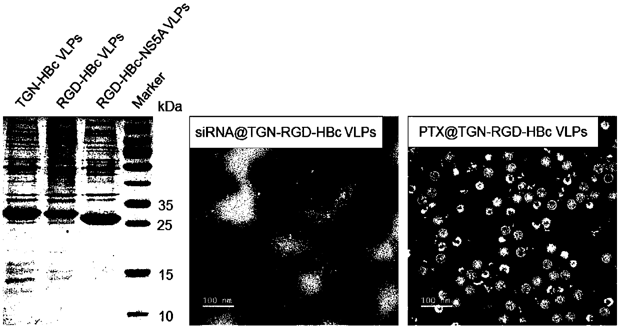 Cross-barrier targeted drug delivery system for lesions, drug-carrier system and host cell system