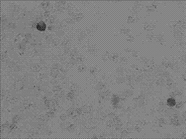 mRNA (Messenger Ribose Nucleic Acid) horizontal in-situ hybridization detection kit of MSMB at early stage of prostate canceration and detection method and application thereof