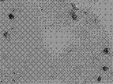 mRNA (Messenger Ribose Nucleic Acid) horizontal in-situ hybridization detection kit of MSMB at early stage of prostate canceration and detection method and application thereof