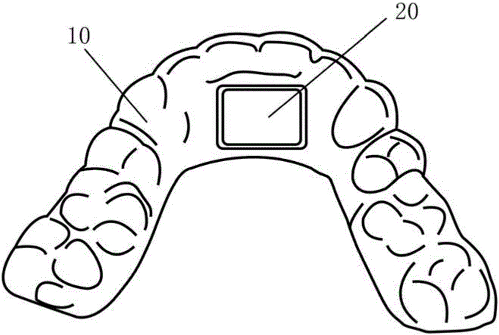 Multifunctional intelligent invisible orthodontic braces and making method thereof