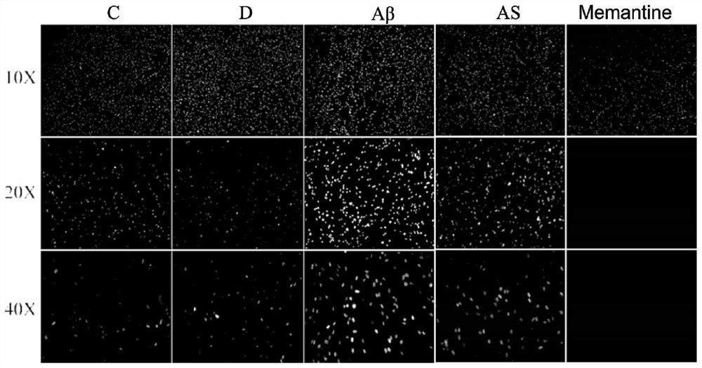 Application of astragaloside in preparation of medicine for preventing Alzheimer's disease