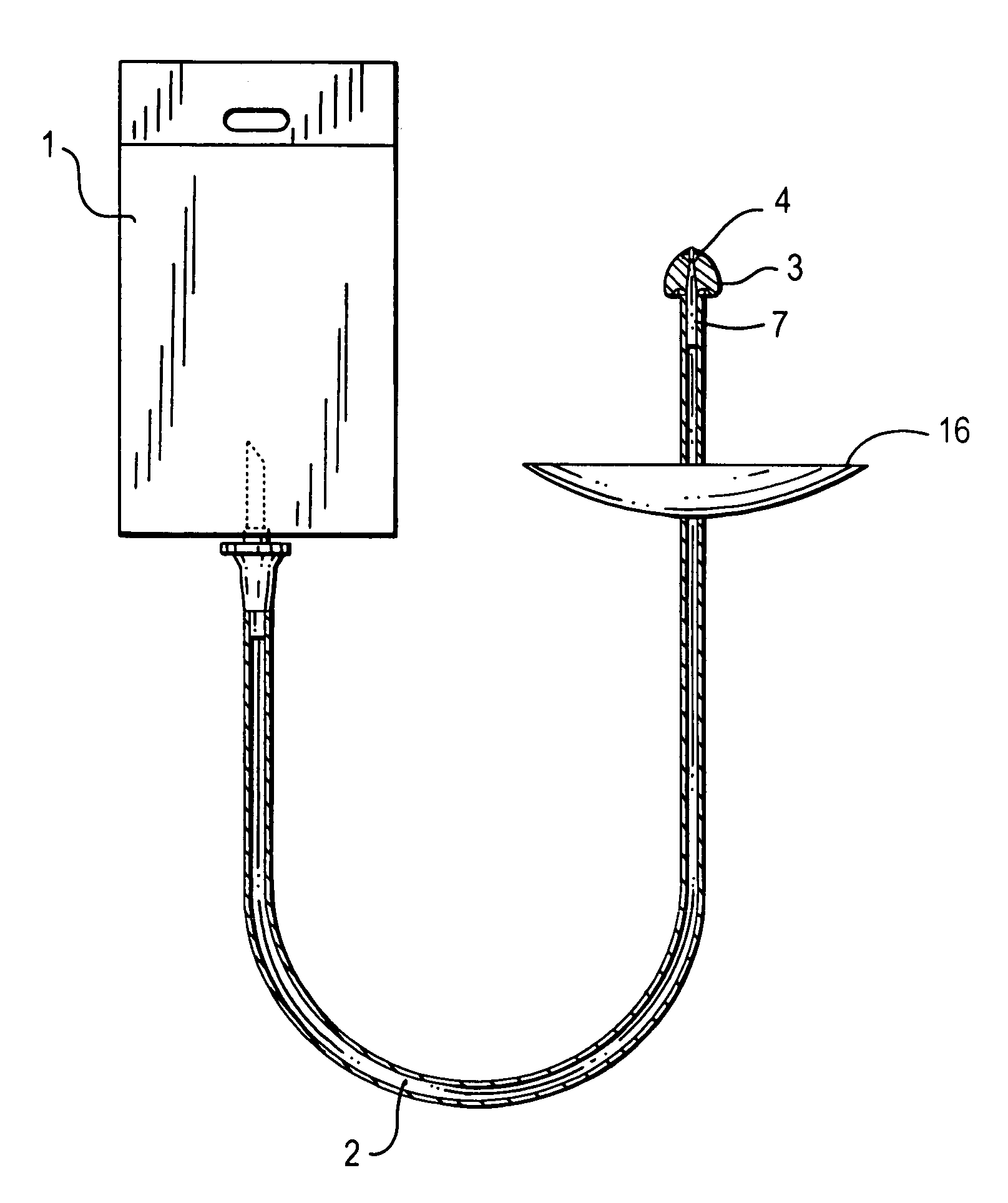 Device for washing or irrigation of the vaginal cavity and the urethral ostium