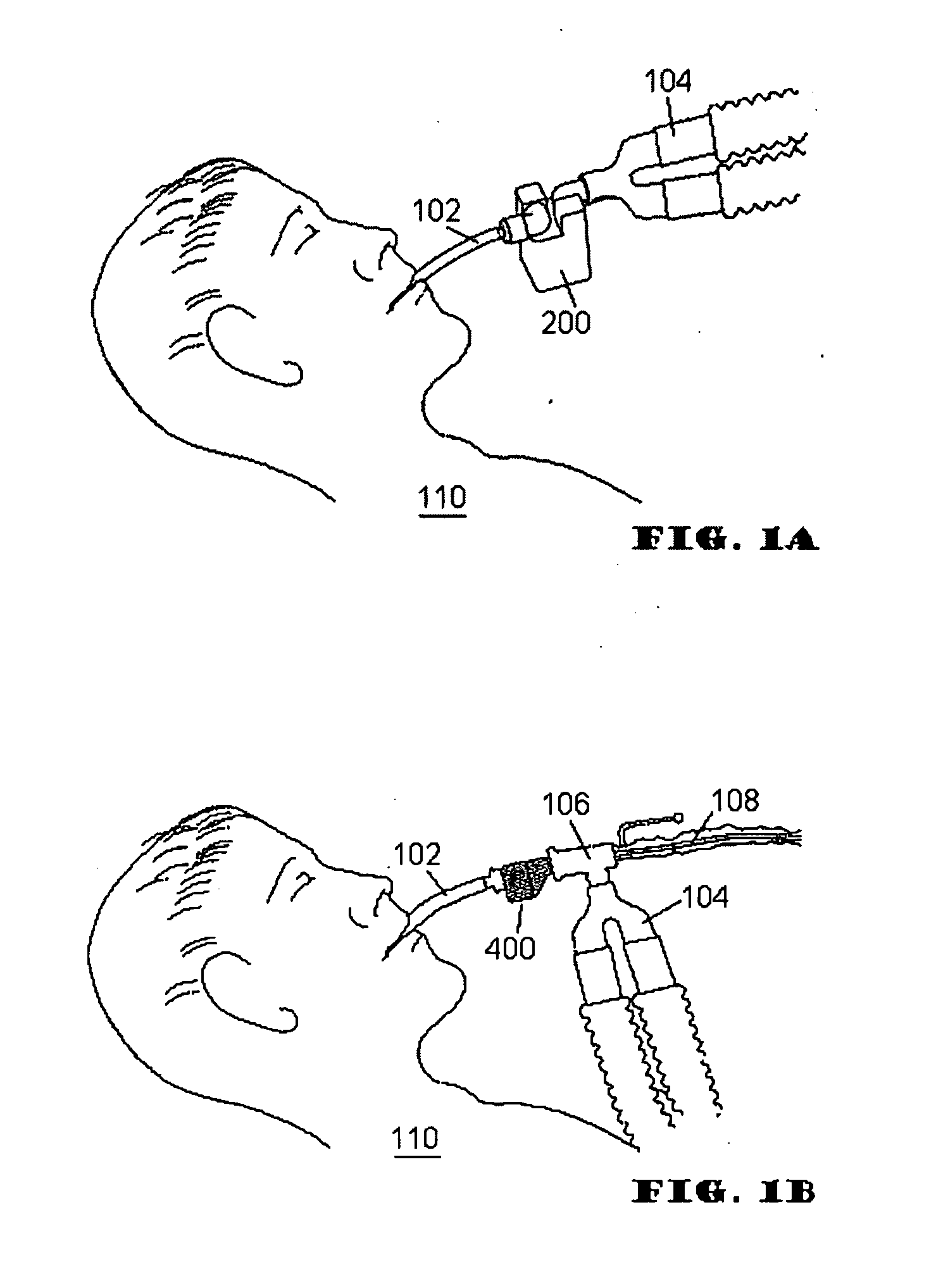 Respiratory secretion retention device, system and method