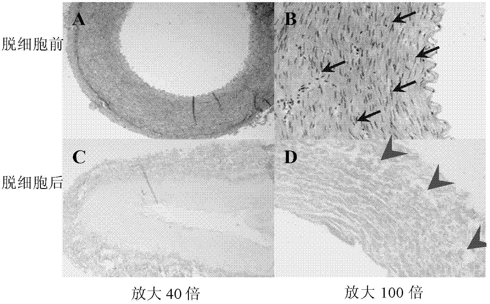 Biological small-diameter artificial blood vessel and preparation method thereof