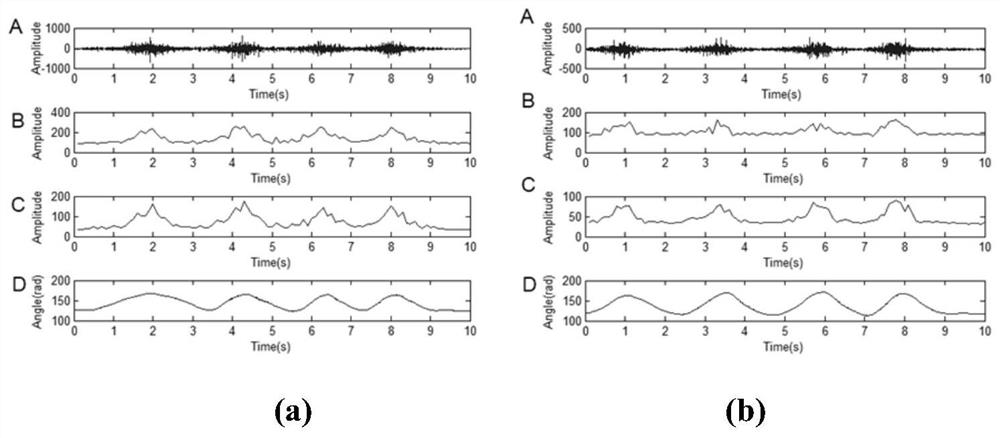 Joint Motion Estimation Method Based on EMG Model and Unscented Kalman Filter