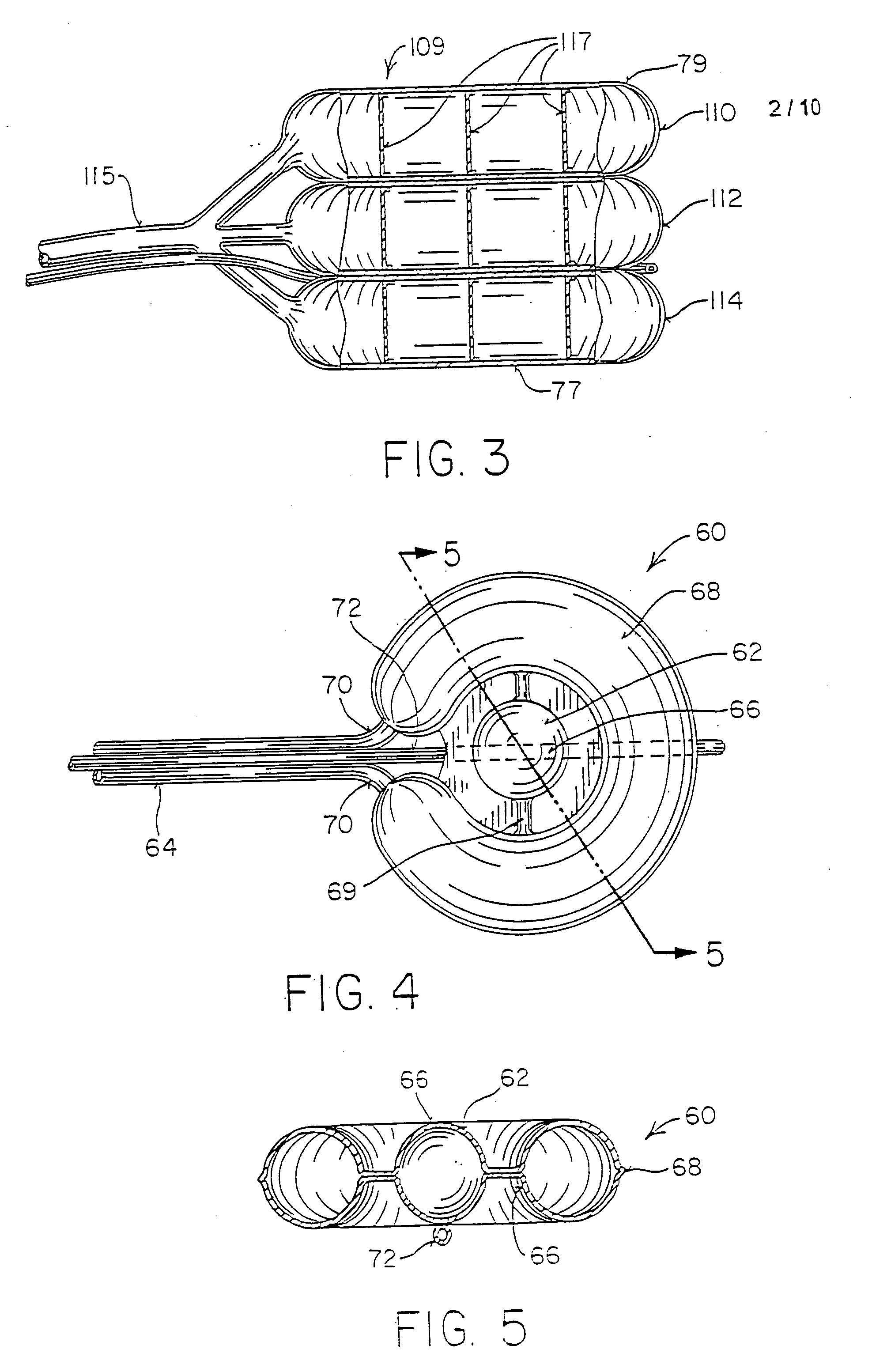 Vertebral body having an altered native cancellous bone volume and related treatment methods