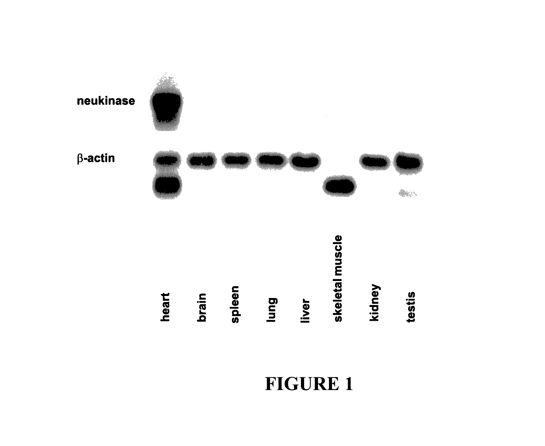 Neukinase, a downstream protein of neuregulin