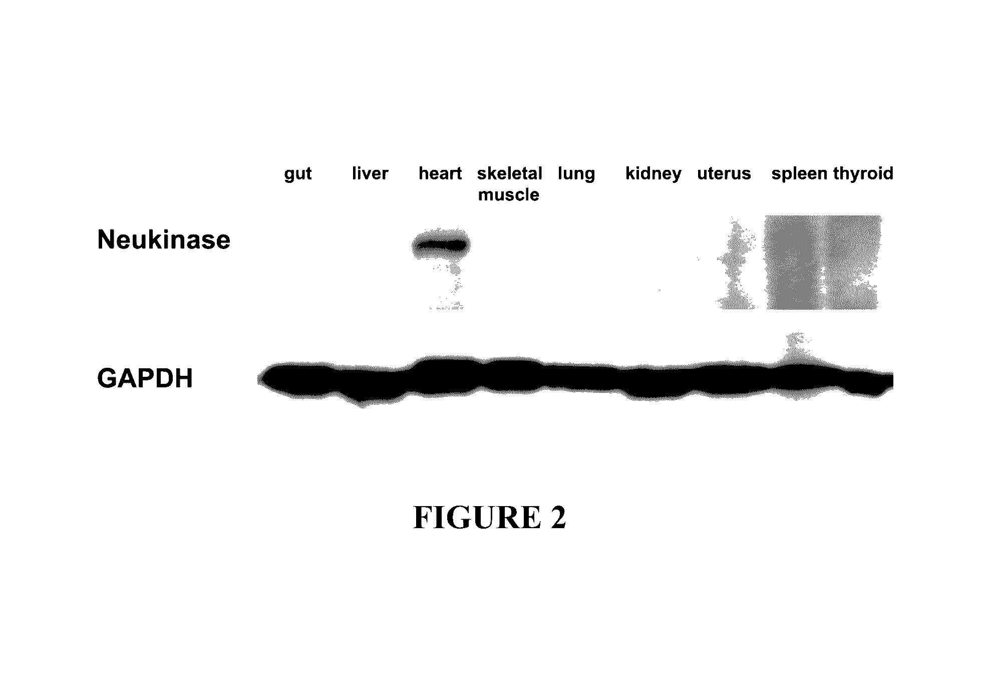 Neukinase, a downstream protein of neuregulin