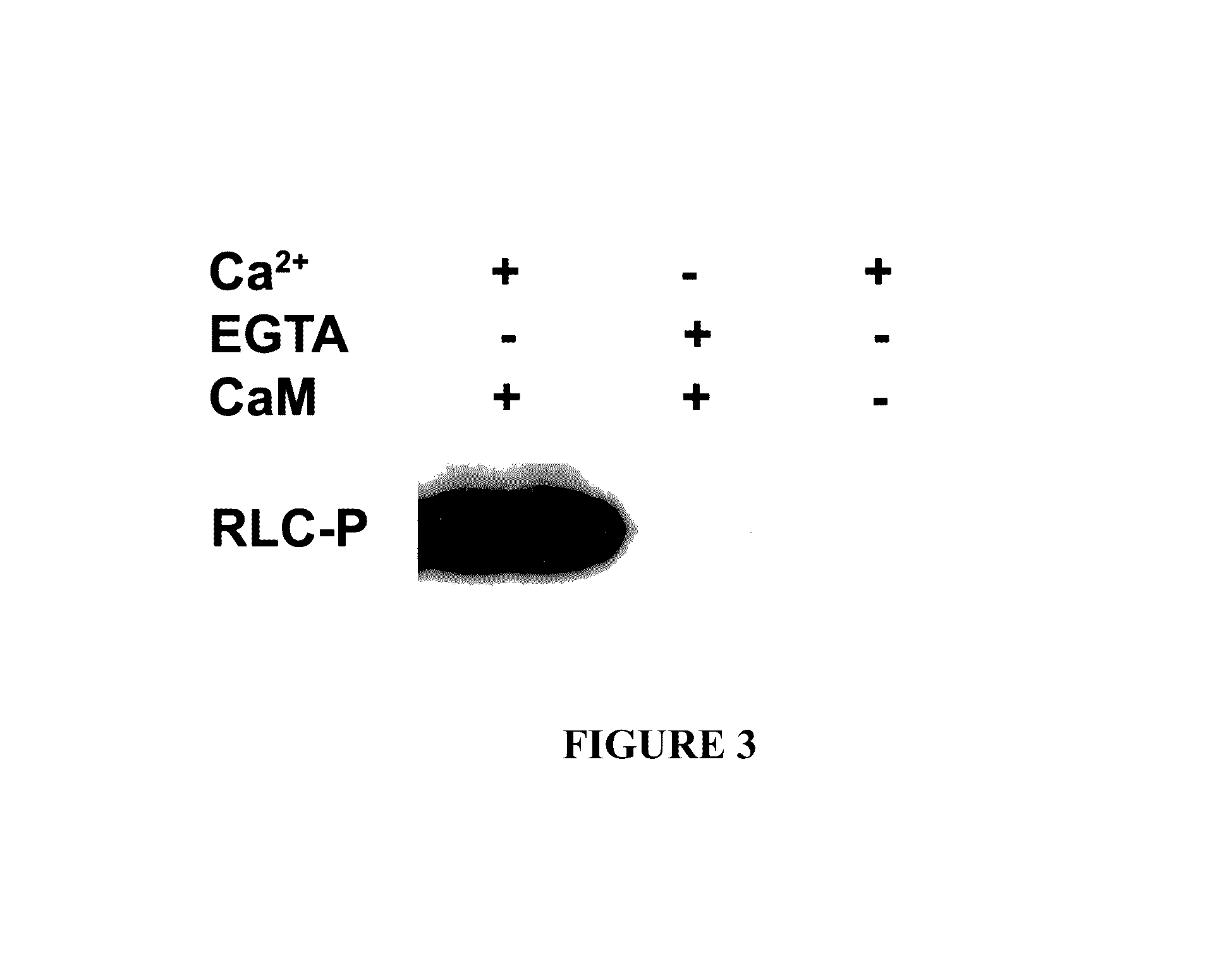 Neukinase, a downstream protein of neuregulin