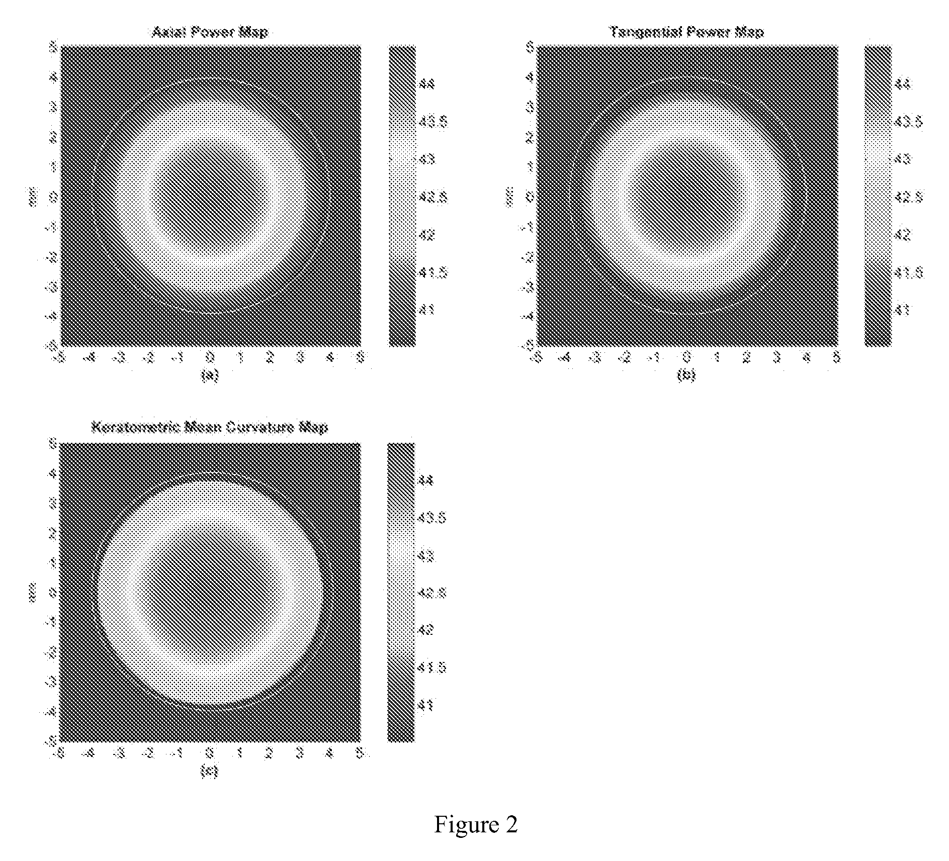 Gaussian fitting on mean curvature maps of parameterization of corneal ectatic diseases