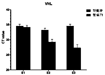 Renal cancer exosome marker group and application thereof