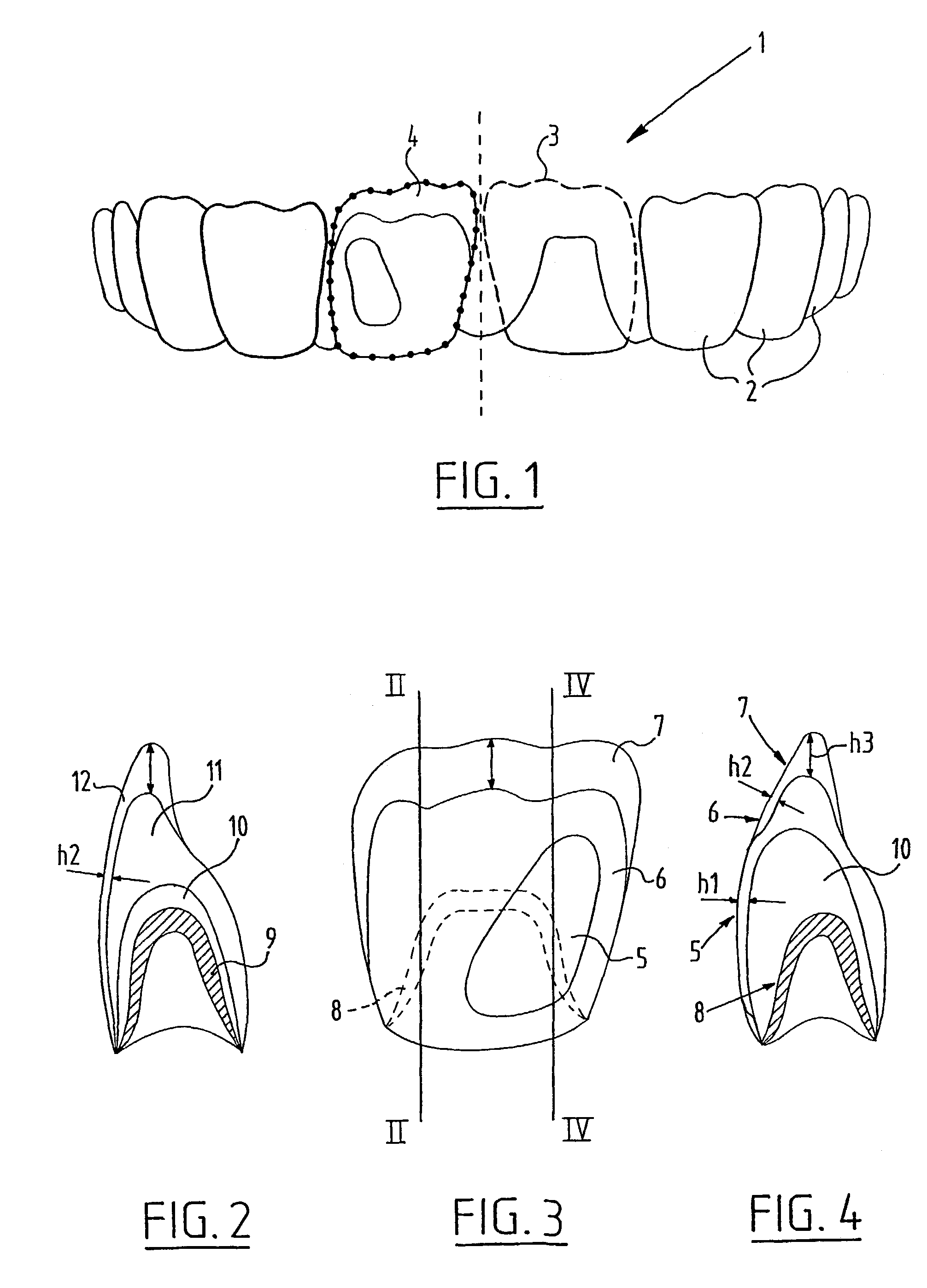 Method for production of an artificial tooth