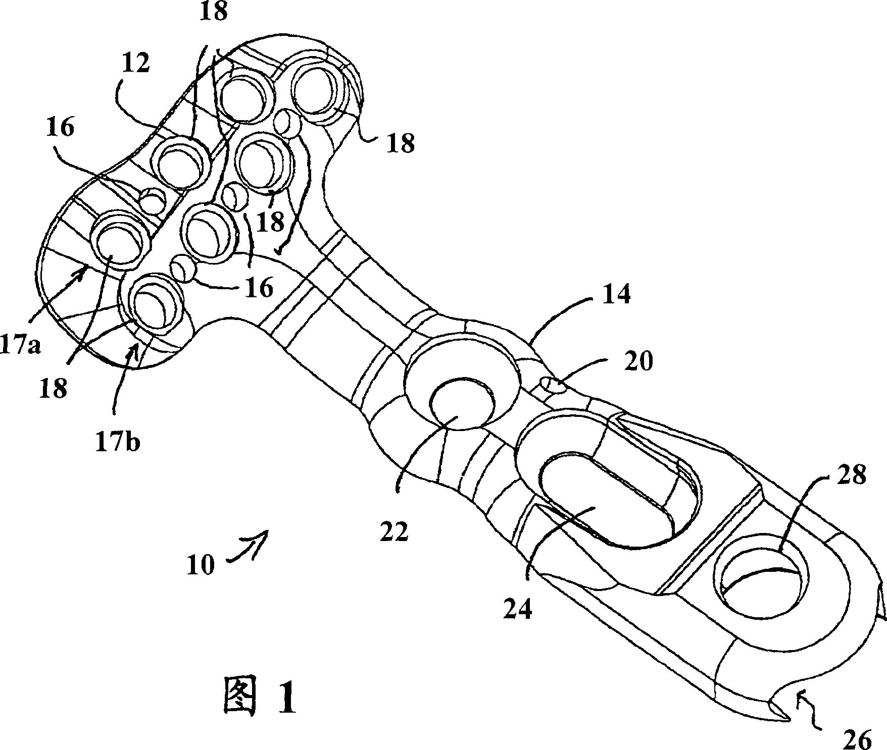 Modular fracture fixation plate system