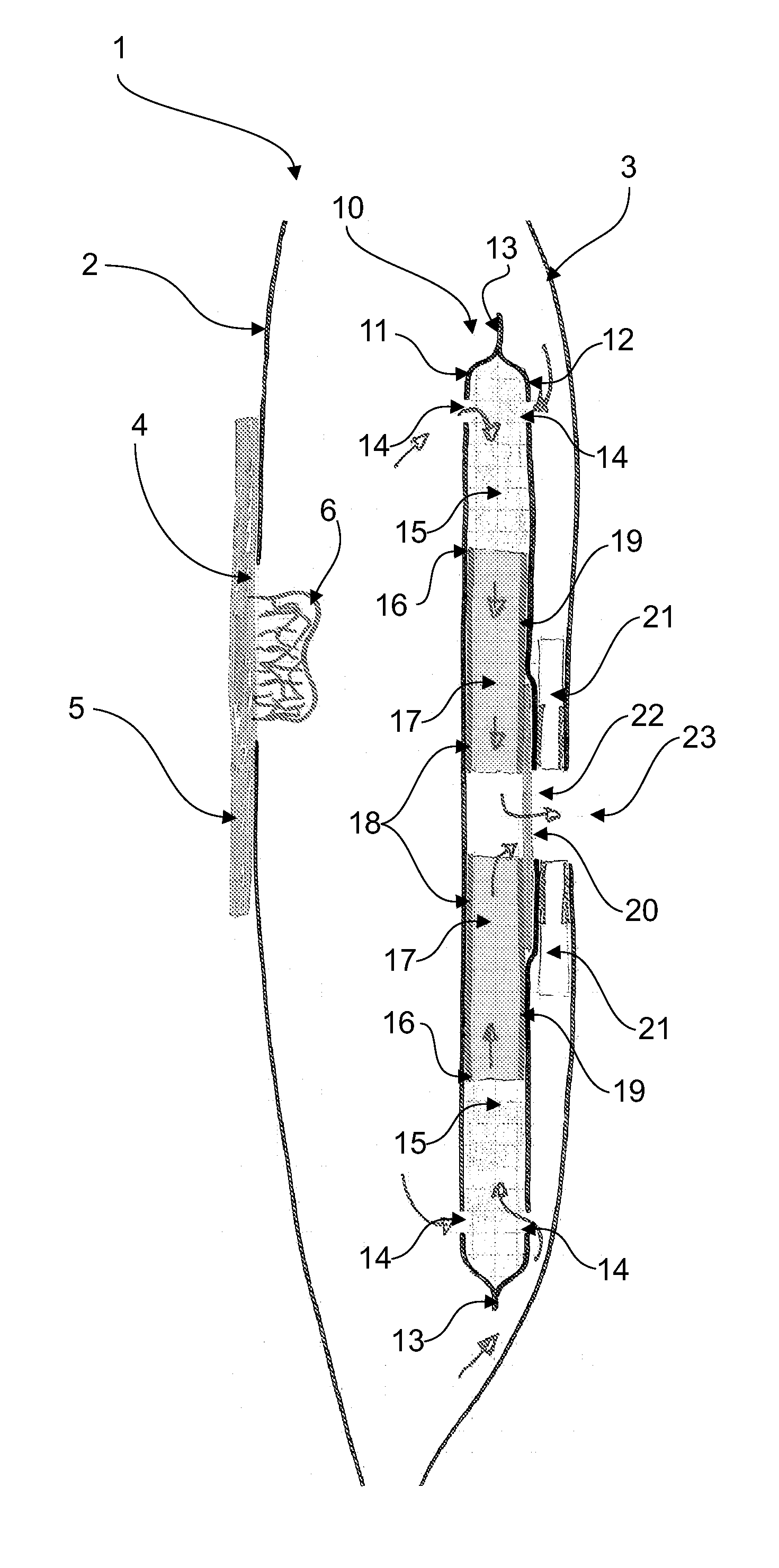 Ostomy bag with a filter construction