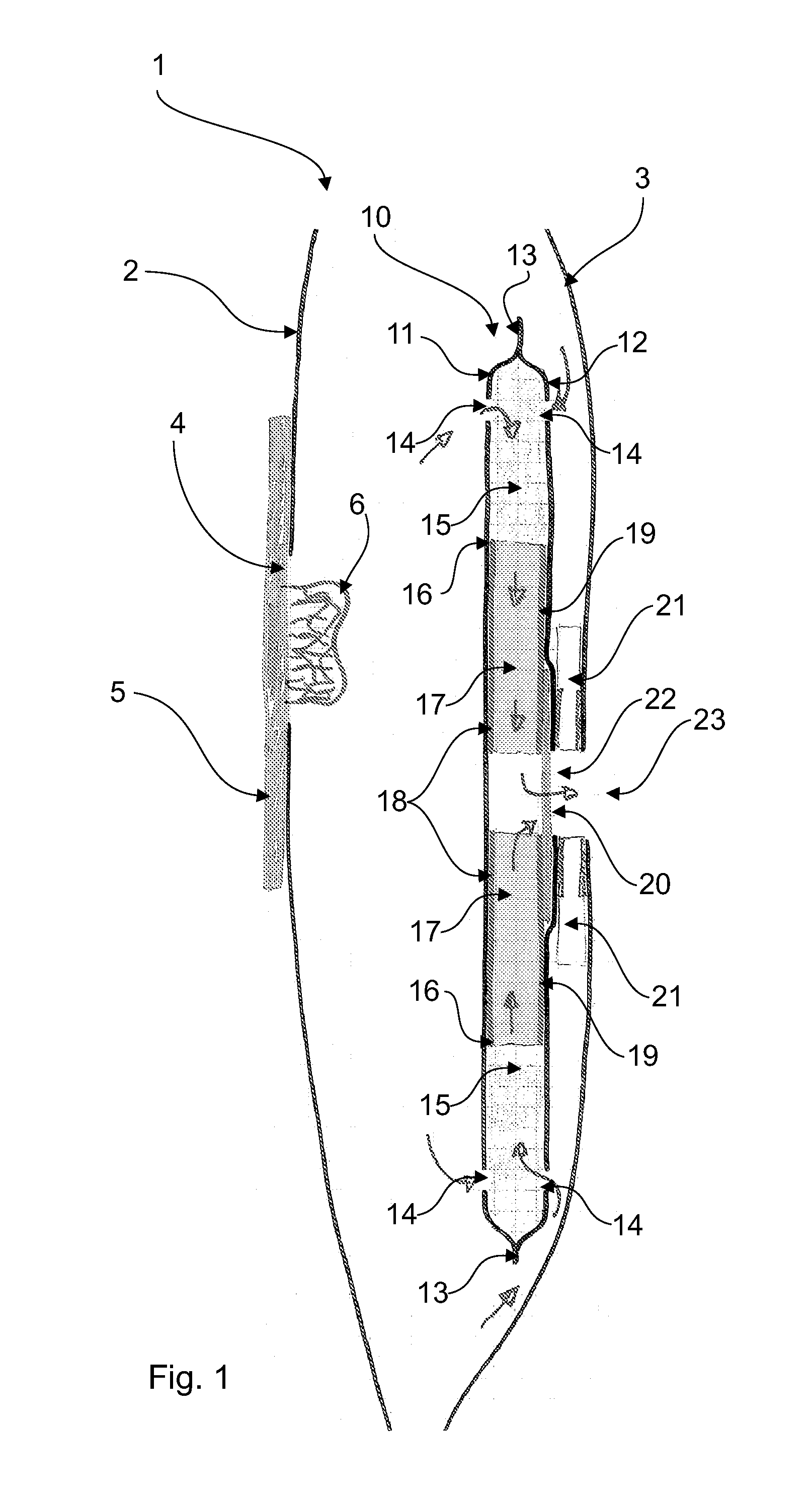 Ostomy bag with a filter construction